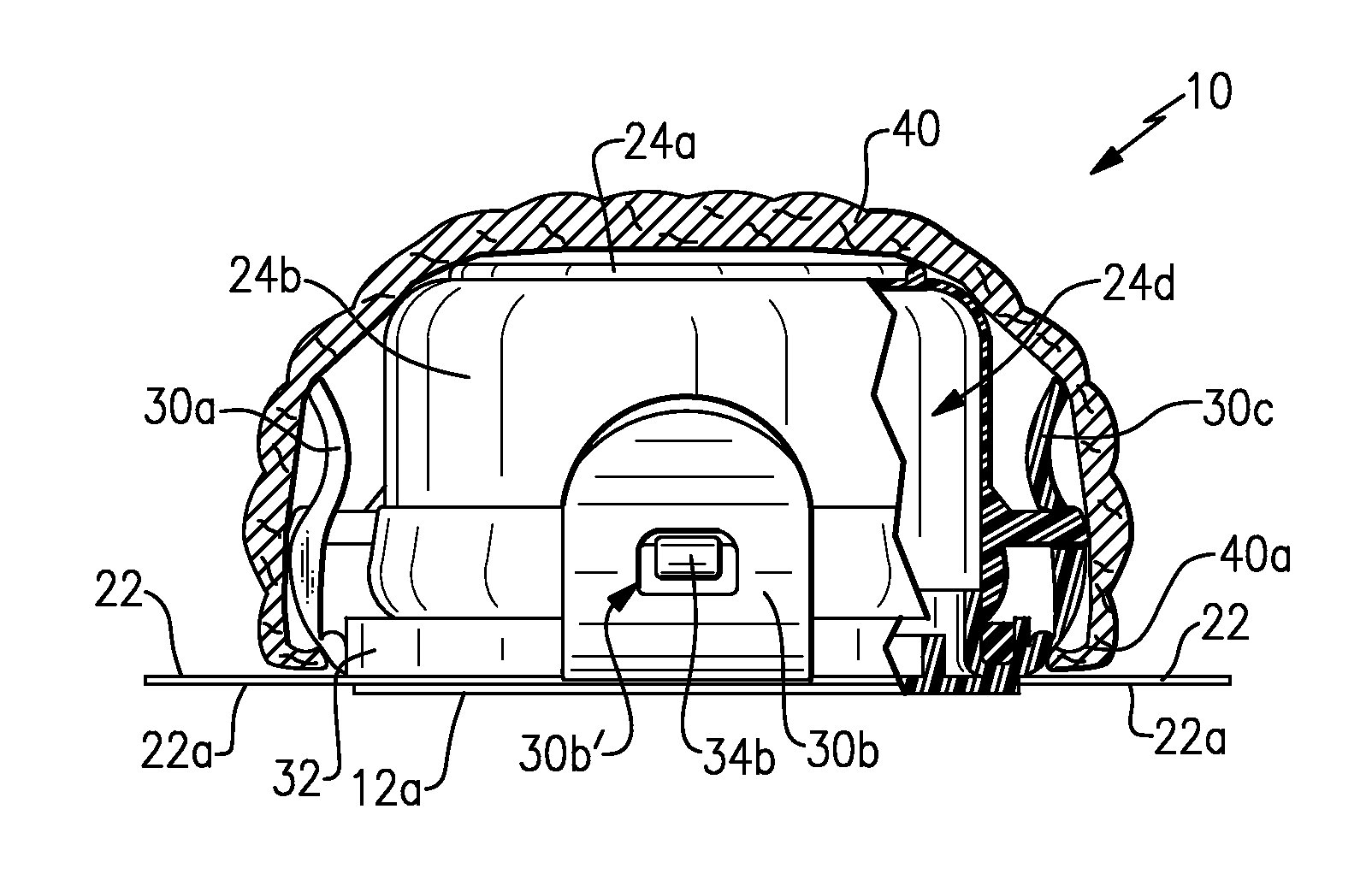 Ostomy Appliance and Method