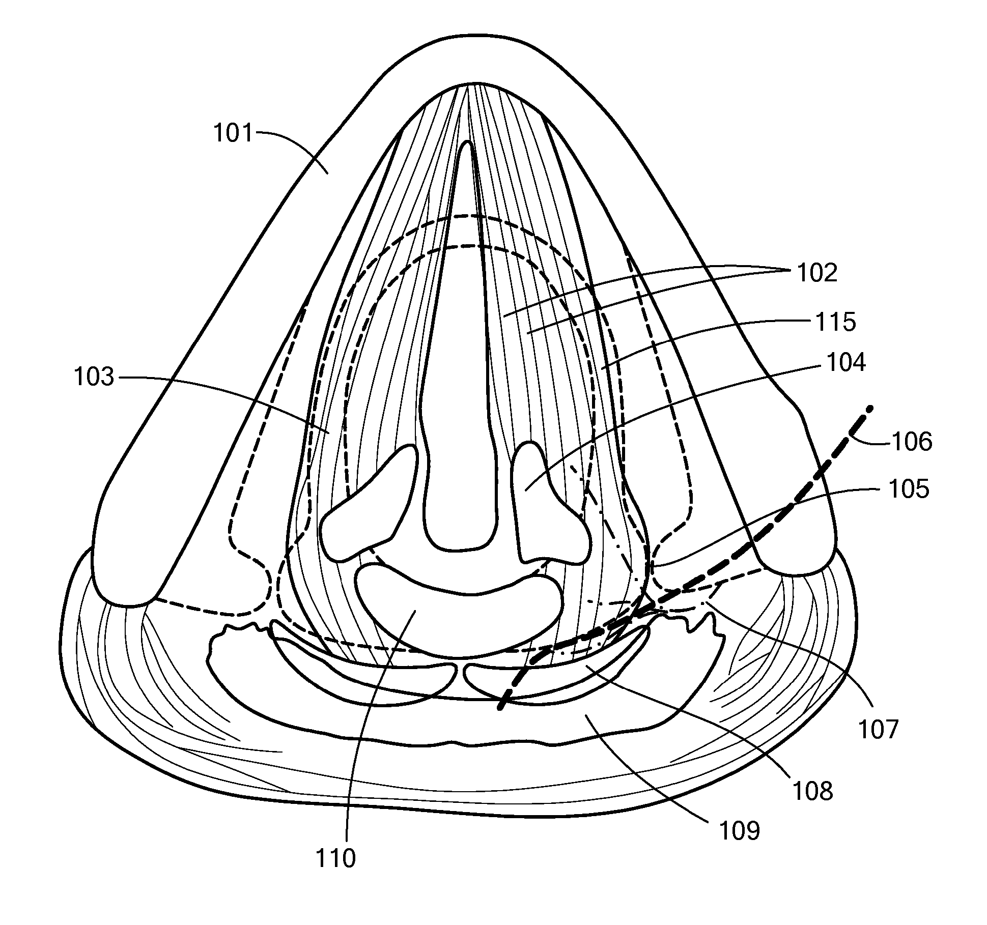 System, Apparatus, and Method for Facilitating Interface with Laryngeal Structures