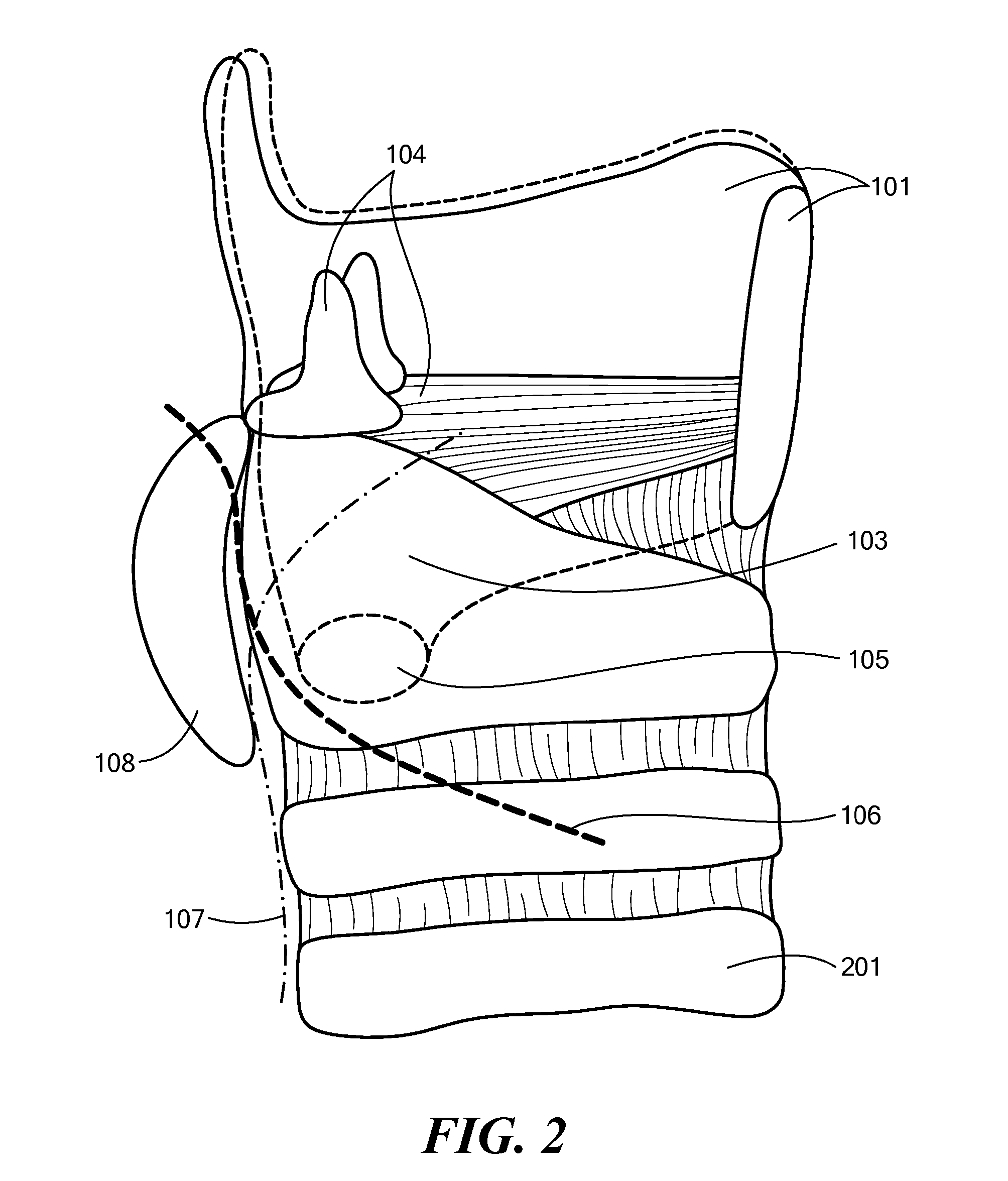 System, Apparatus, and Method for Facilitating Interface with Laryngeal Structures