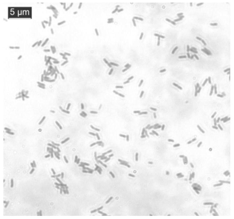 Root nodule endophyte S43 with phosphate solubilizing function and application of root nodule endophyte S43