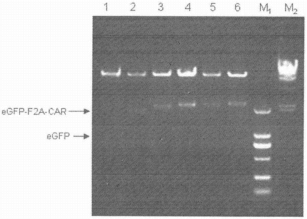 Nucleic acid encoding chimeric antigen receptor protein and t lymphocyte expressing chimeric antigen receptor protein