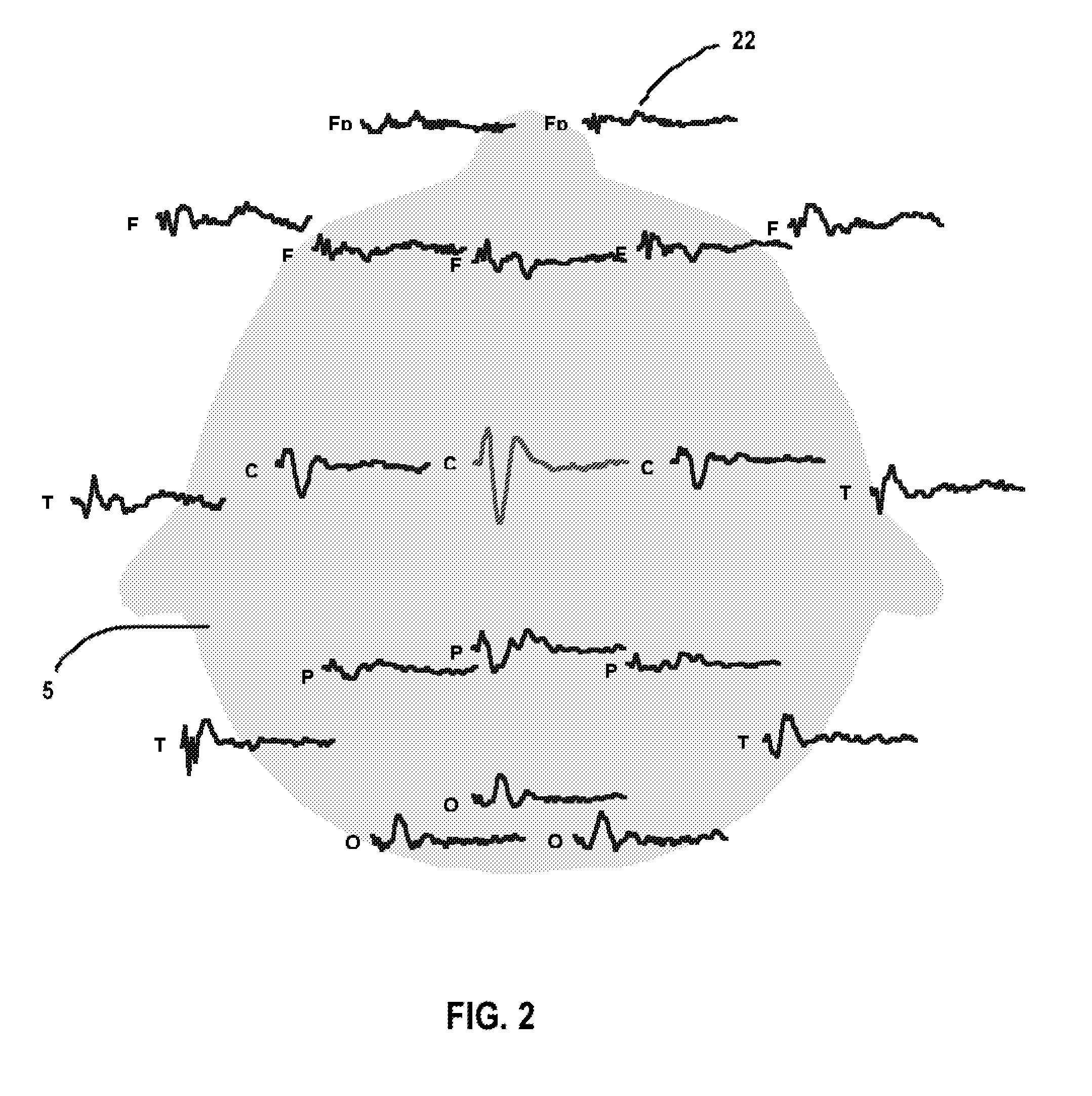 Method and Apparatus for Assessing Neurocognitive Status