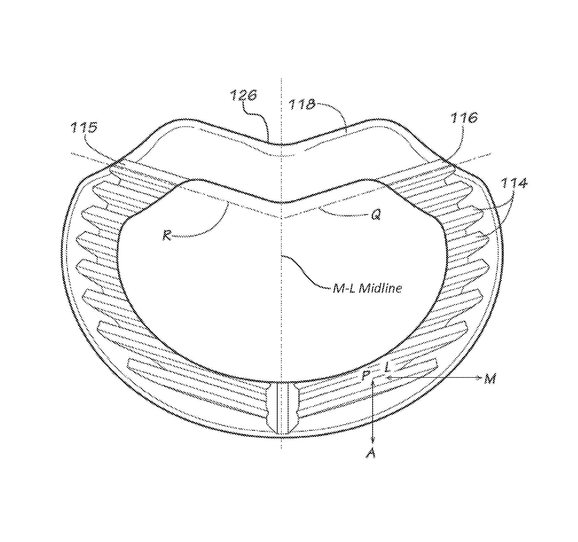 Spinal implants