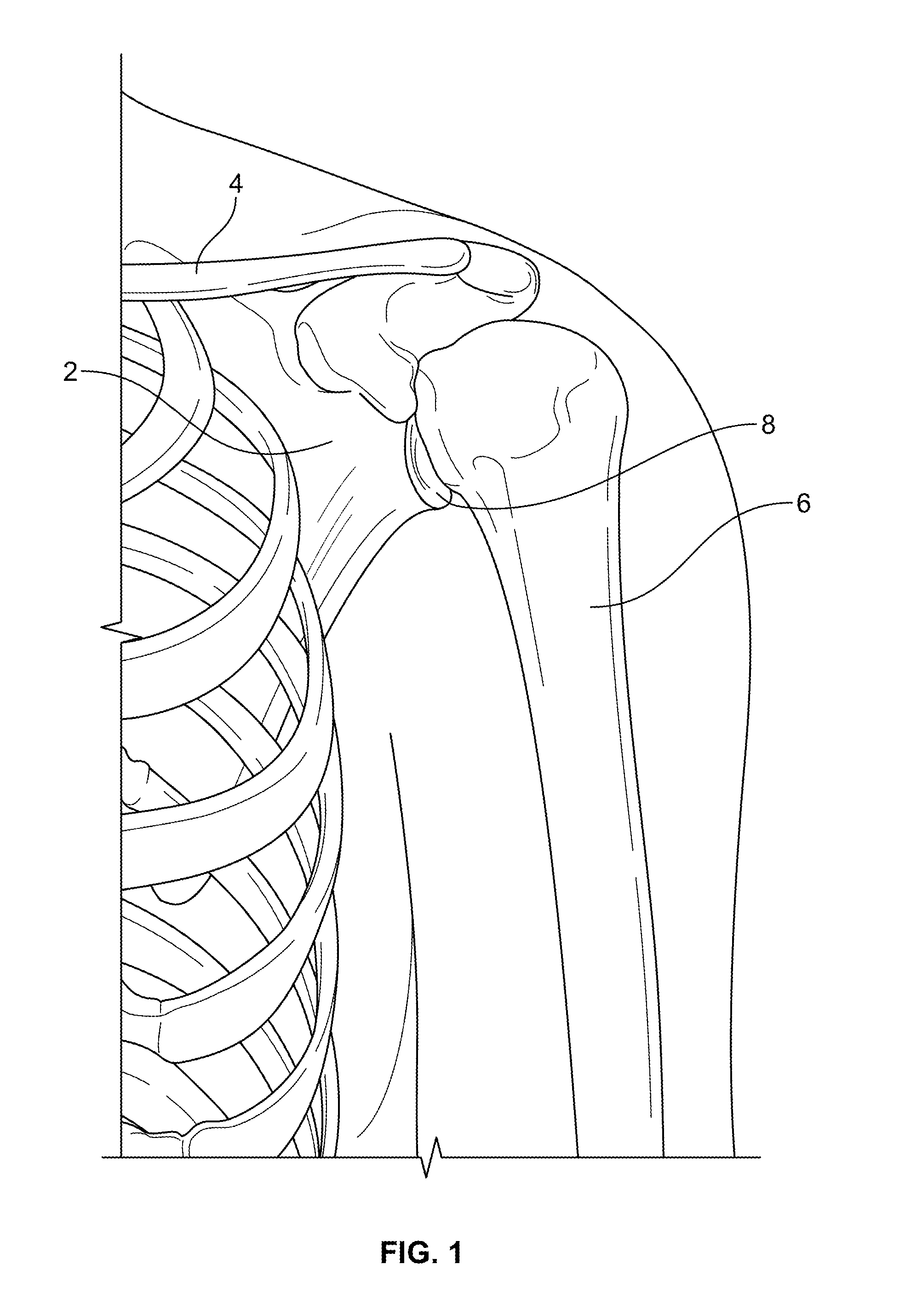 Shape-fit glenoid reaming systems and methods