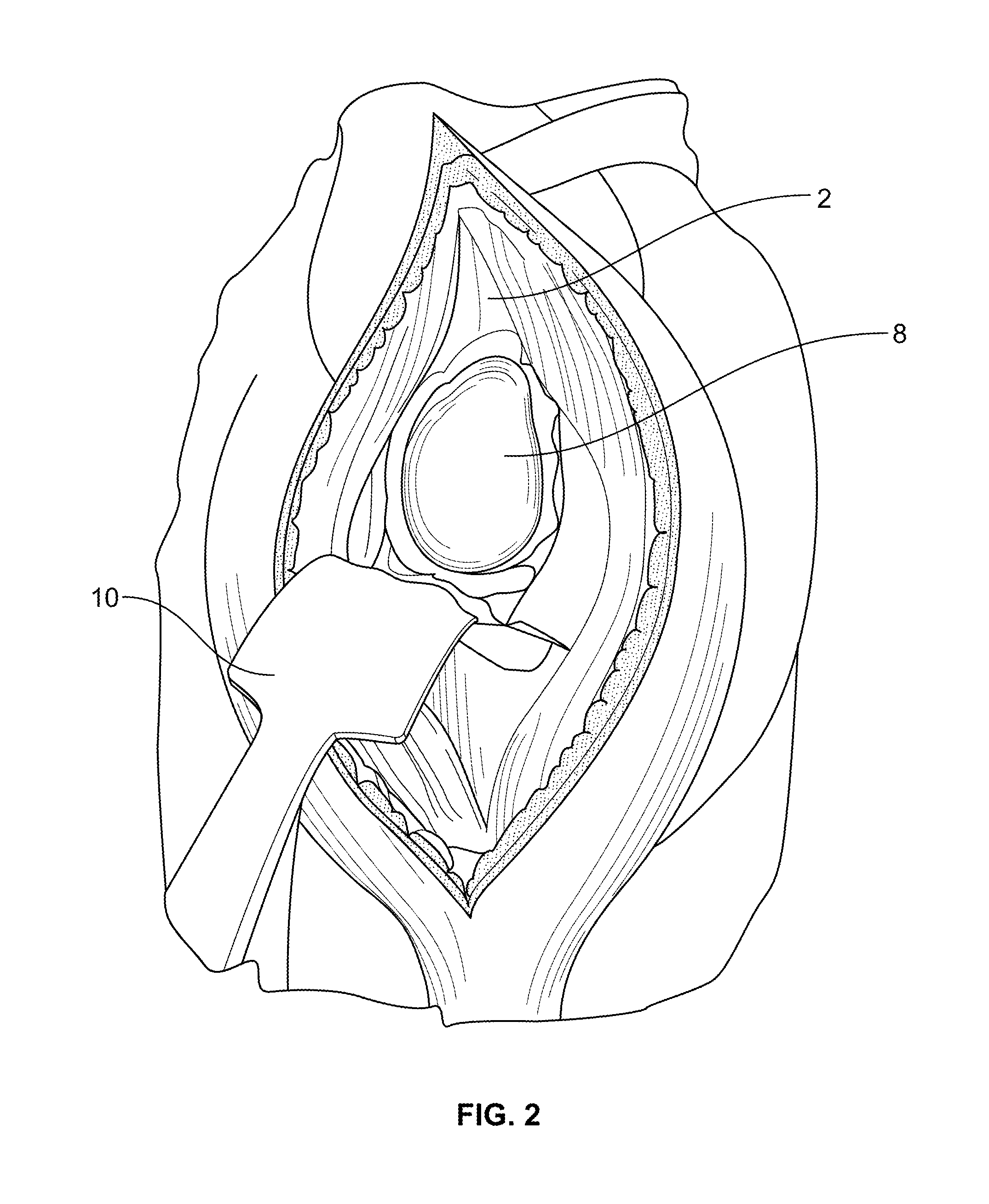 Shape-fit glenoid reaming systems and methods