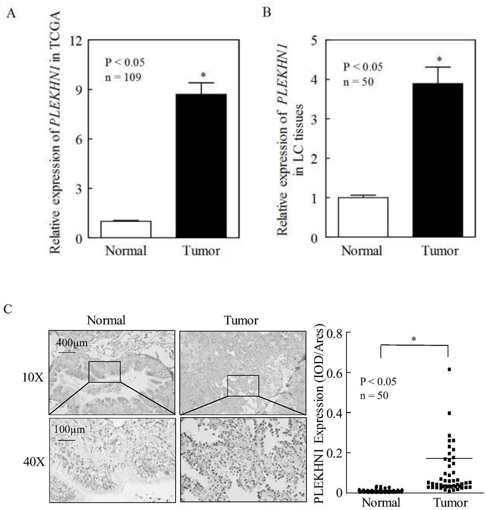 Prevention of lung cancer target plekhn1 and its application