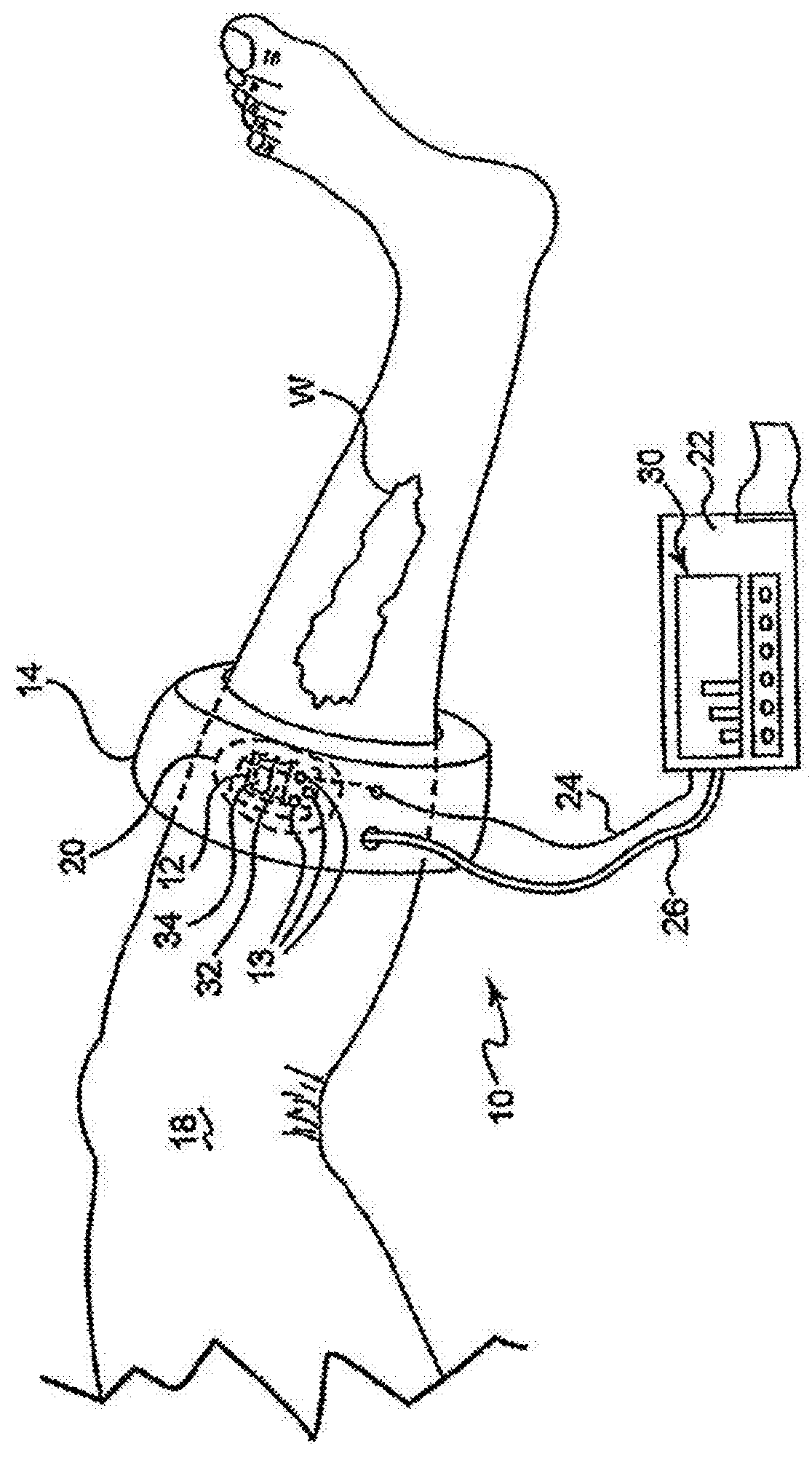 Method and system for assessing severity and stage of peripheral arterial disease and lower extremity wounds using angiosome mapping