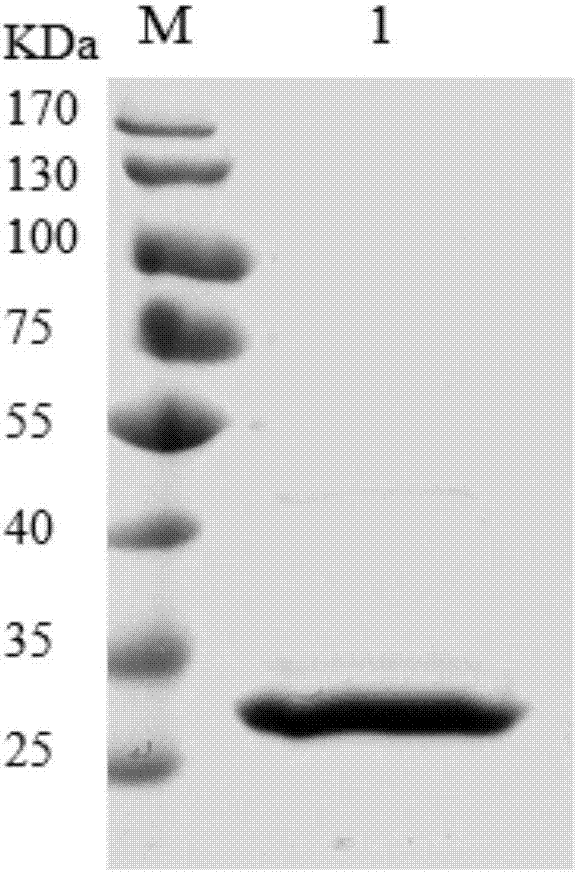 Escherichia coli engineering bacteria for expressing pseudomonas putida creatininase and application thereof