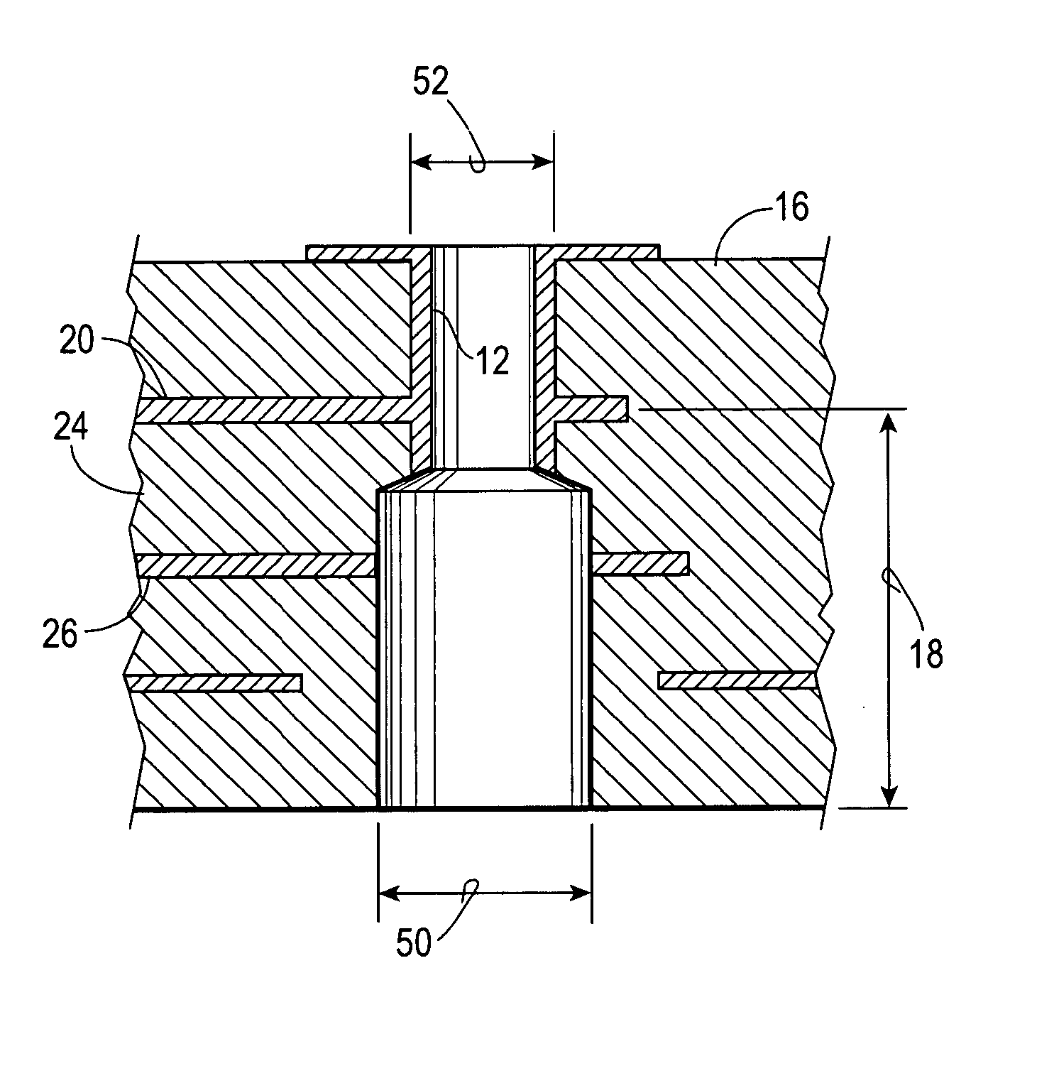 Closed loop backdrilling system