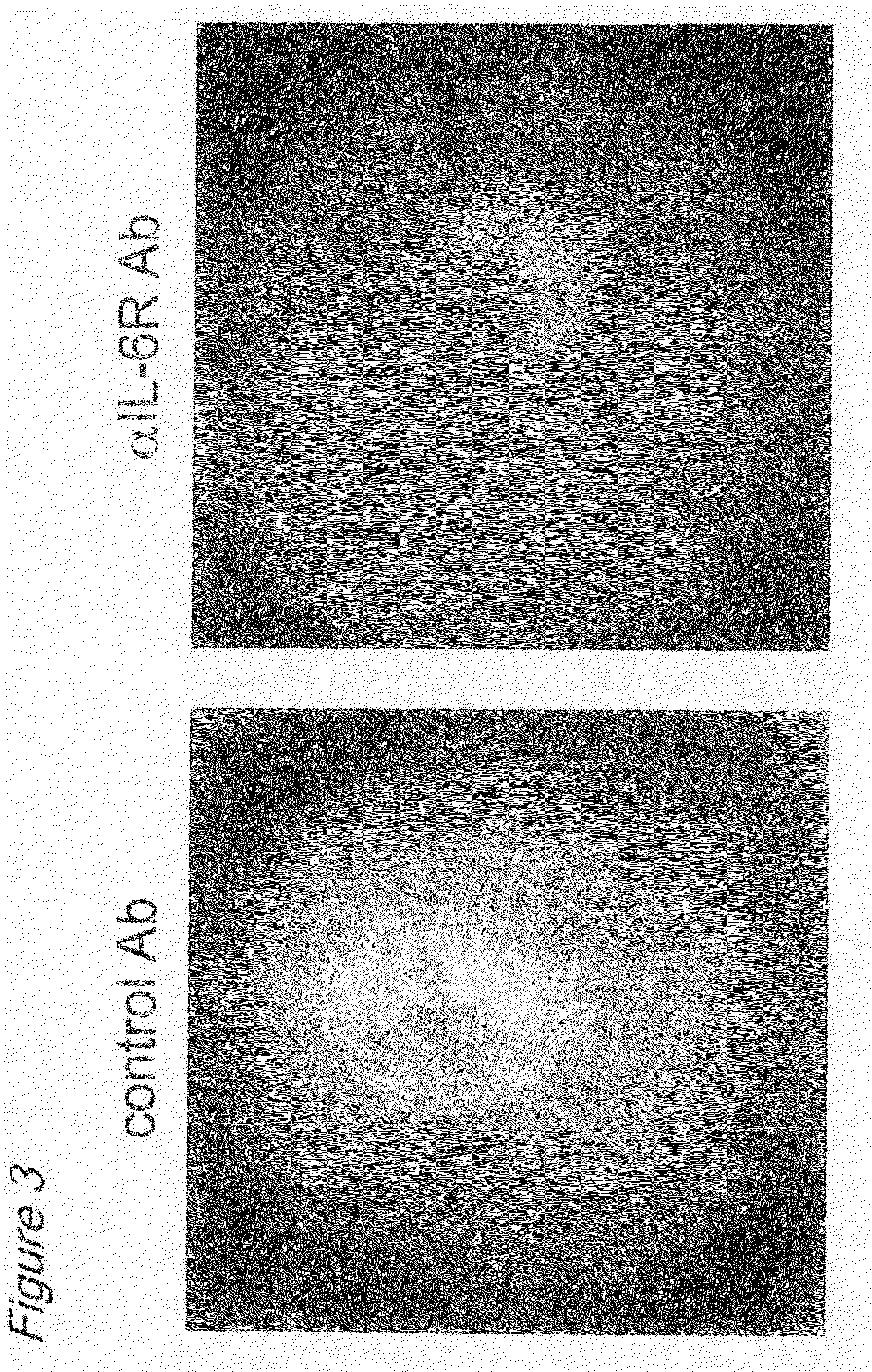 Therapeutic agents for ocular inflammatory disease comprising interleukin 6 receptor inhibitor as active ingredient