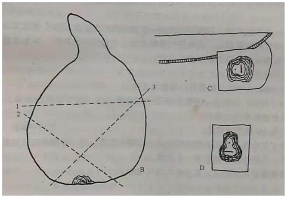 Method for rapid production of root-knot nematode perineal pattern