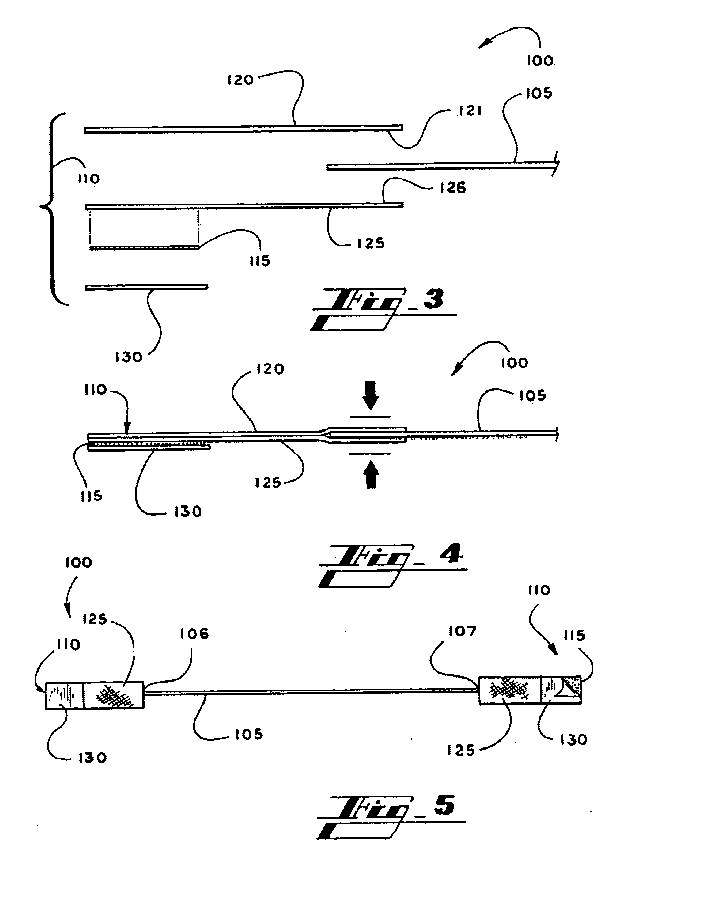 Band nasal dilator