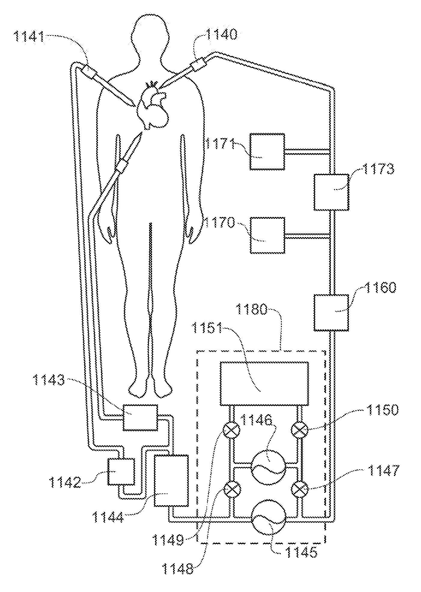 Systems, Devices and Methods for Cardiopulmonary Treatment and Procedures