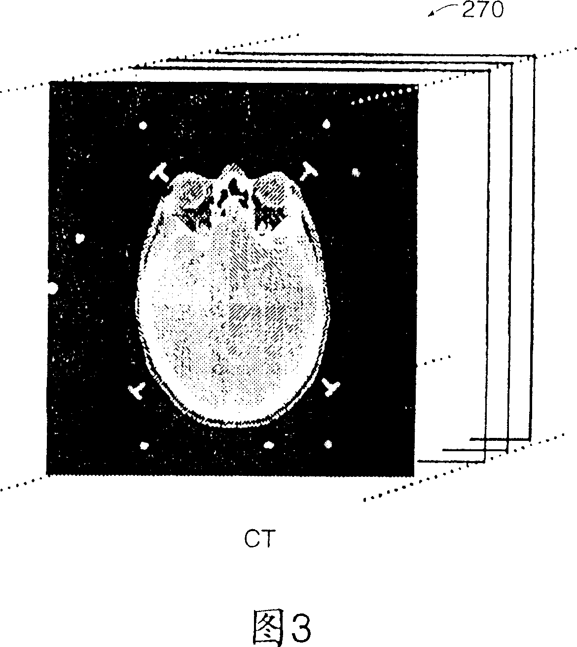 Automated image fusion/alignment system and method