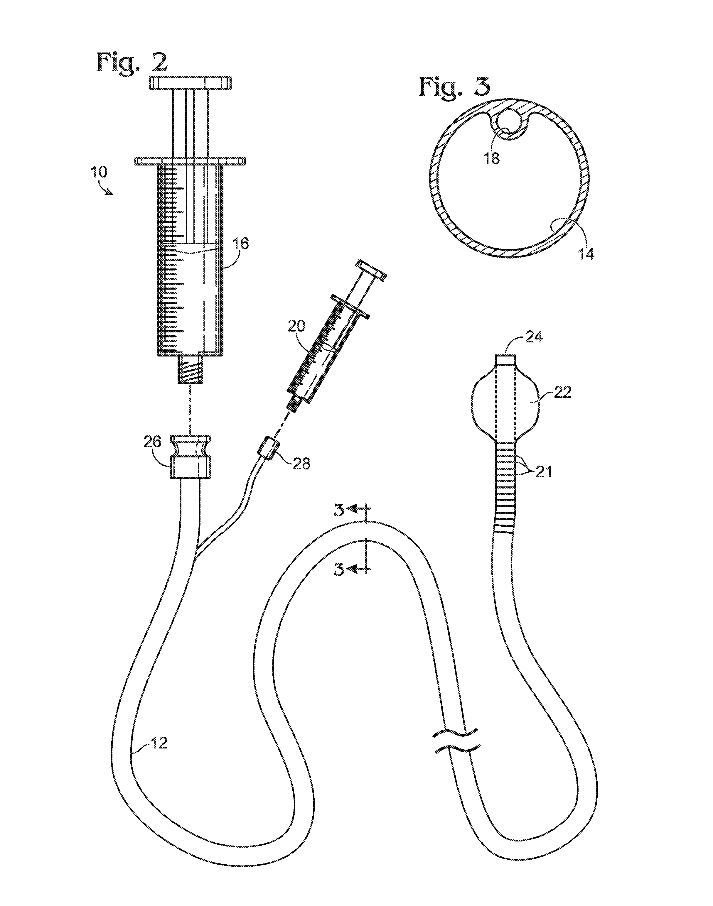 Medical systems and methods