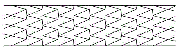 Vascular stent for interventional surgery, method of use thereof, manufacturing method and manufacturing equipment