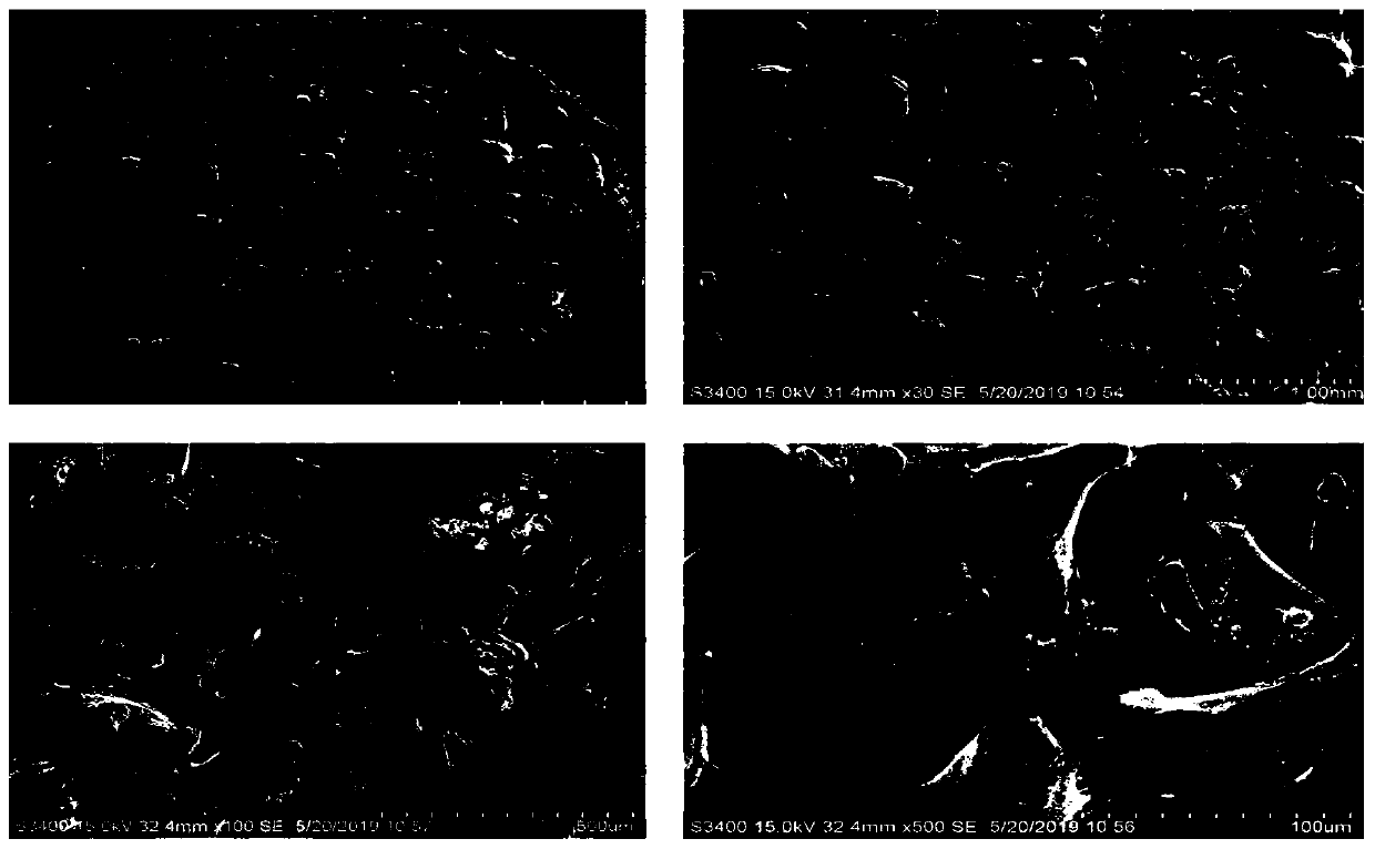 Artificial bones for recovering bone defects of osteoma and preparation method thereof