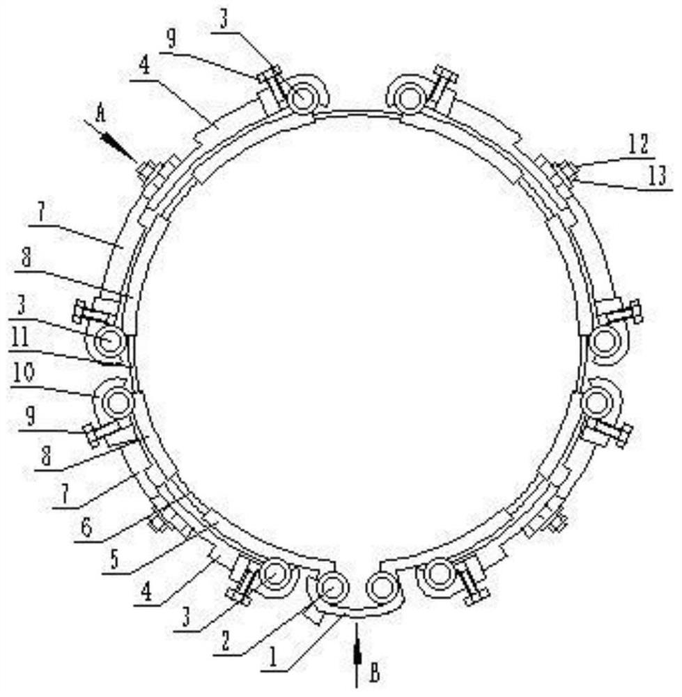 Carbon fiber combined type external fixing frame for fracture adjuvant therapy