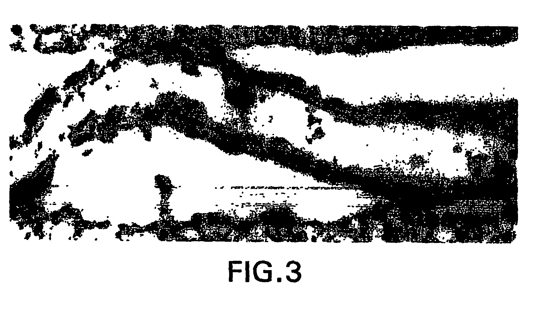 Tissue protective cytokines for the protection, restoration, and enhancement fo responsive cells, tissues and organs