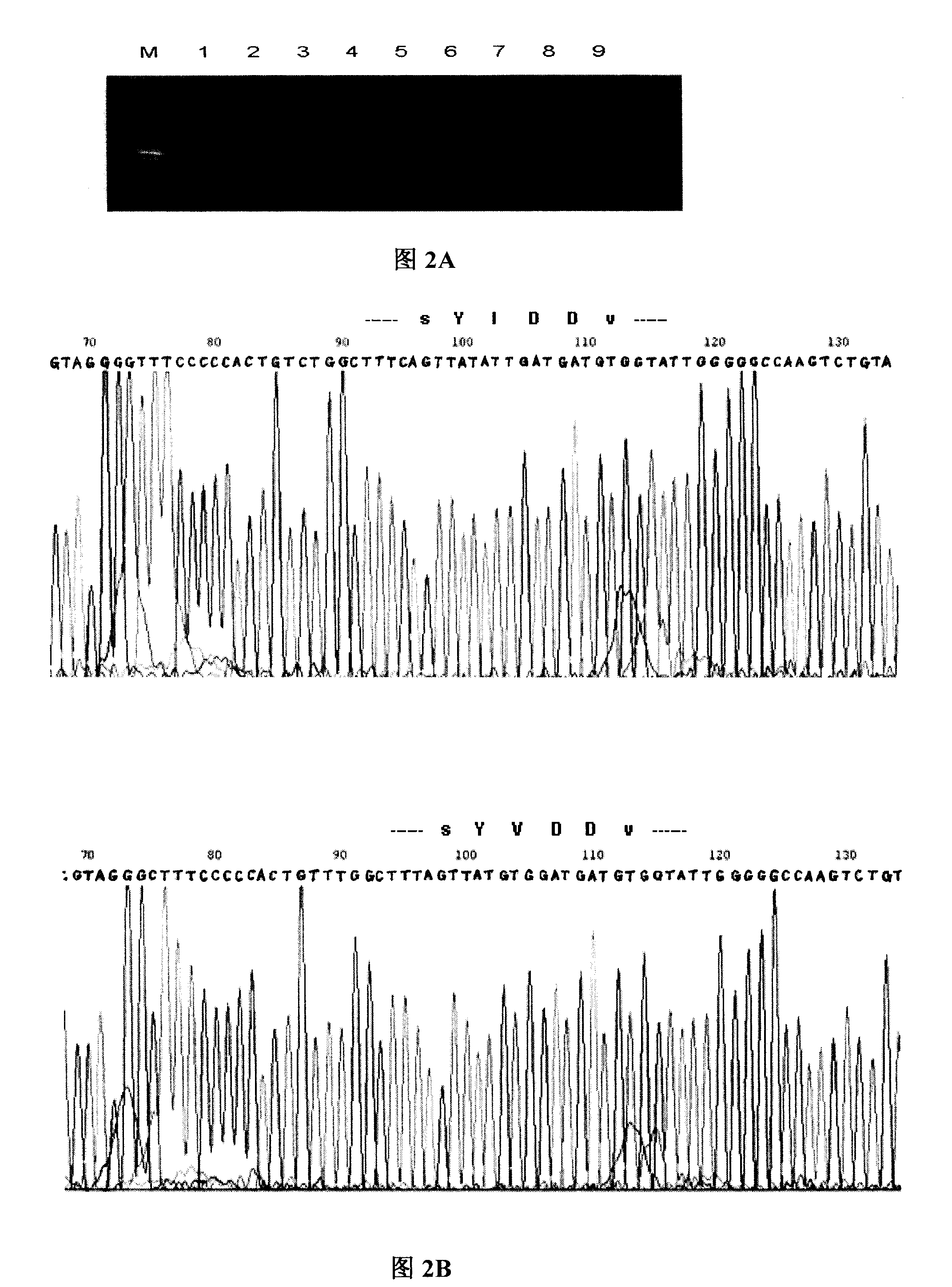 Displacement amplification method for detecting hepatitis B viruse P gene YMDD variation