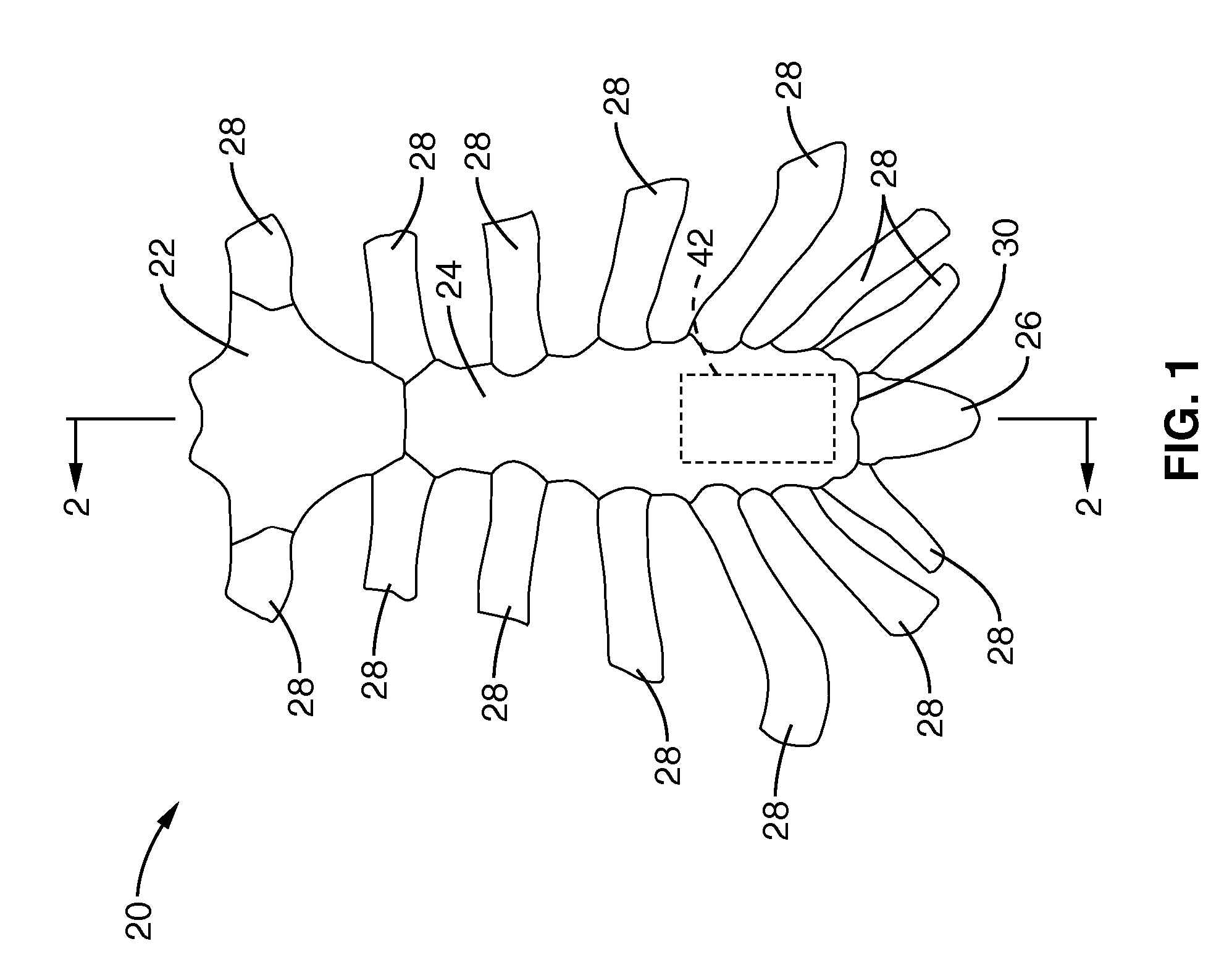 Apparatus and methods for magnetic alteration of anatomical features