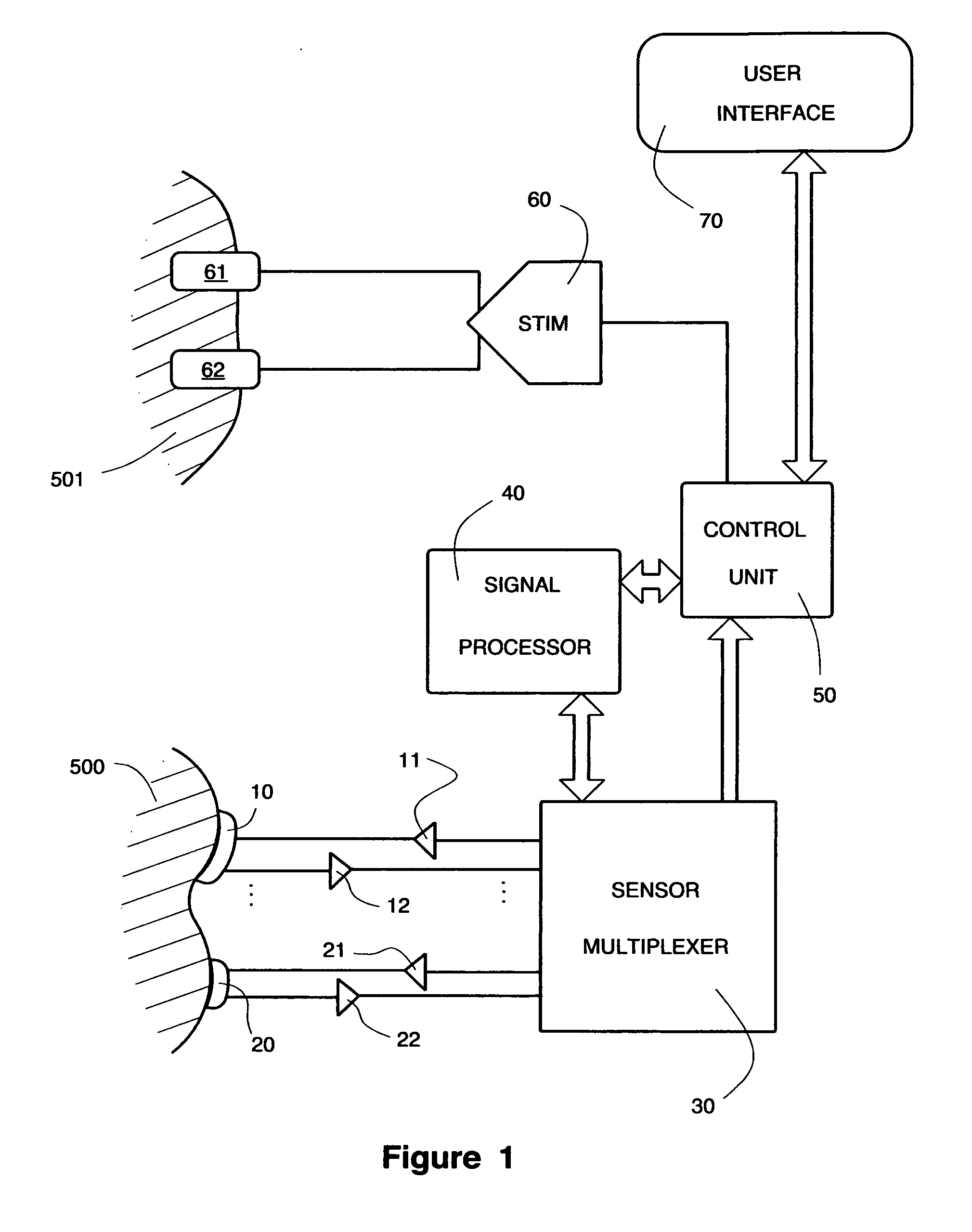 Apparatus and method for treating and preventing formation of pressure ulcers