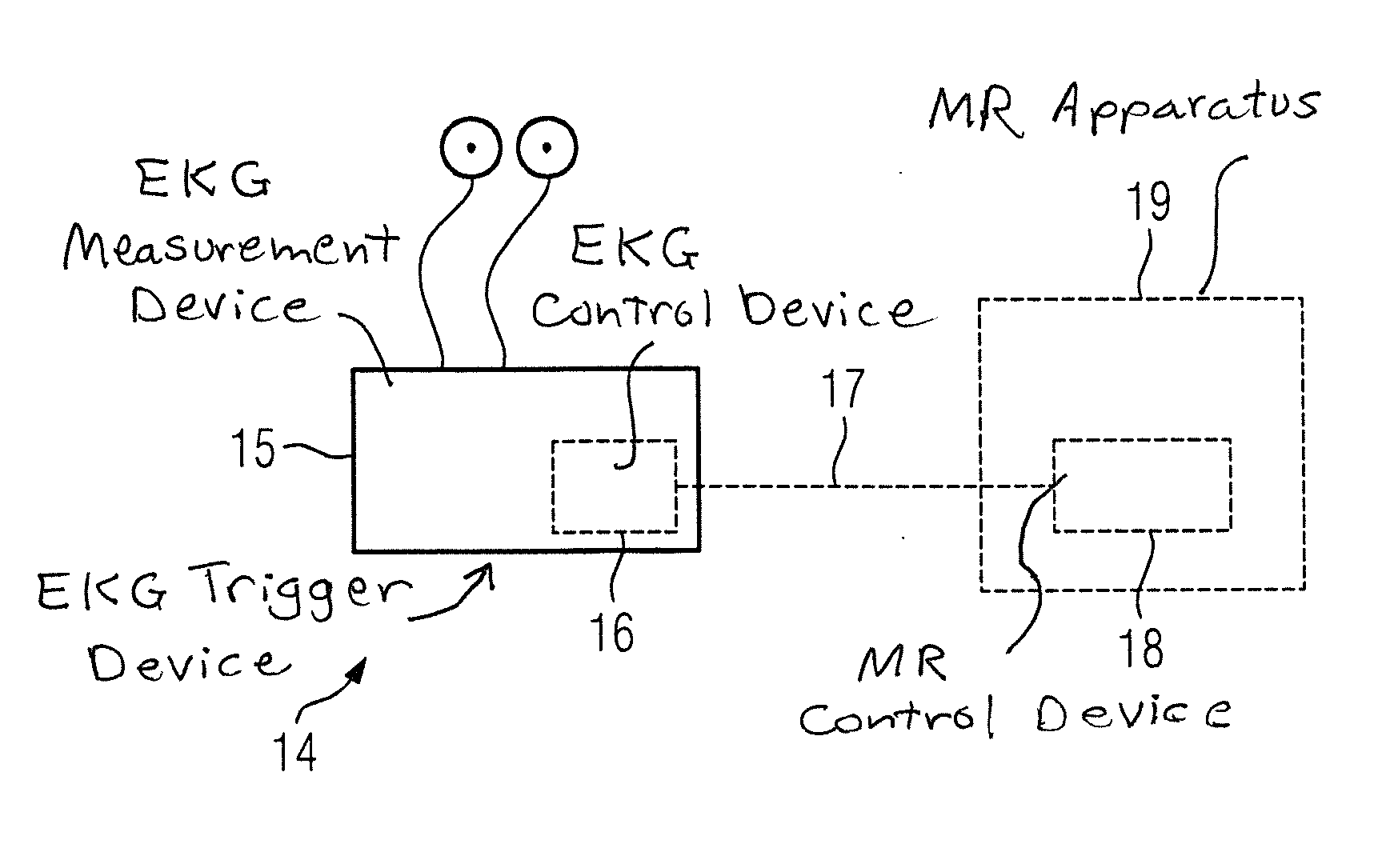 Method and ekg trigger device for correcting an ekg signal in magnetic resonance image acquisition