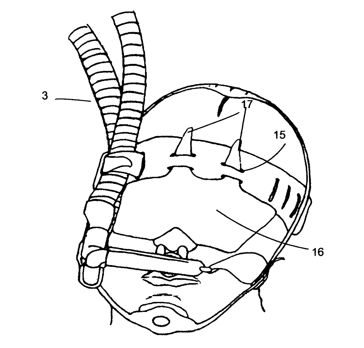 NICU CPAP Cannula 360 Circuitry Support System