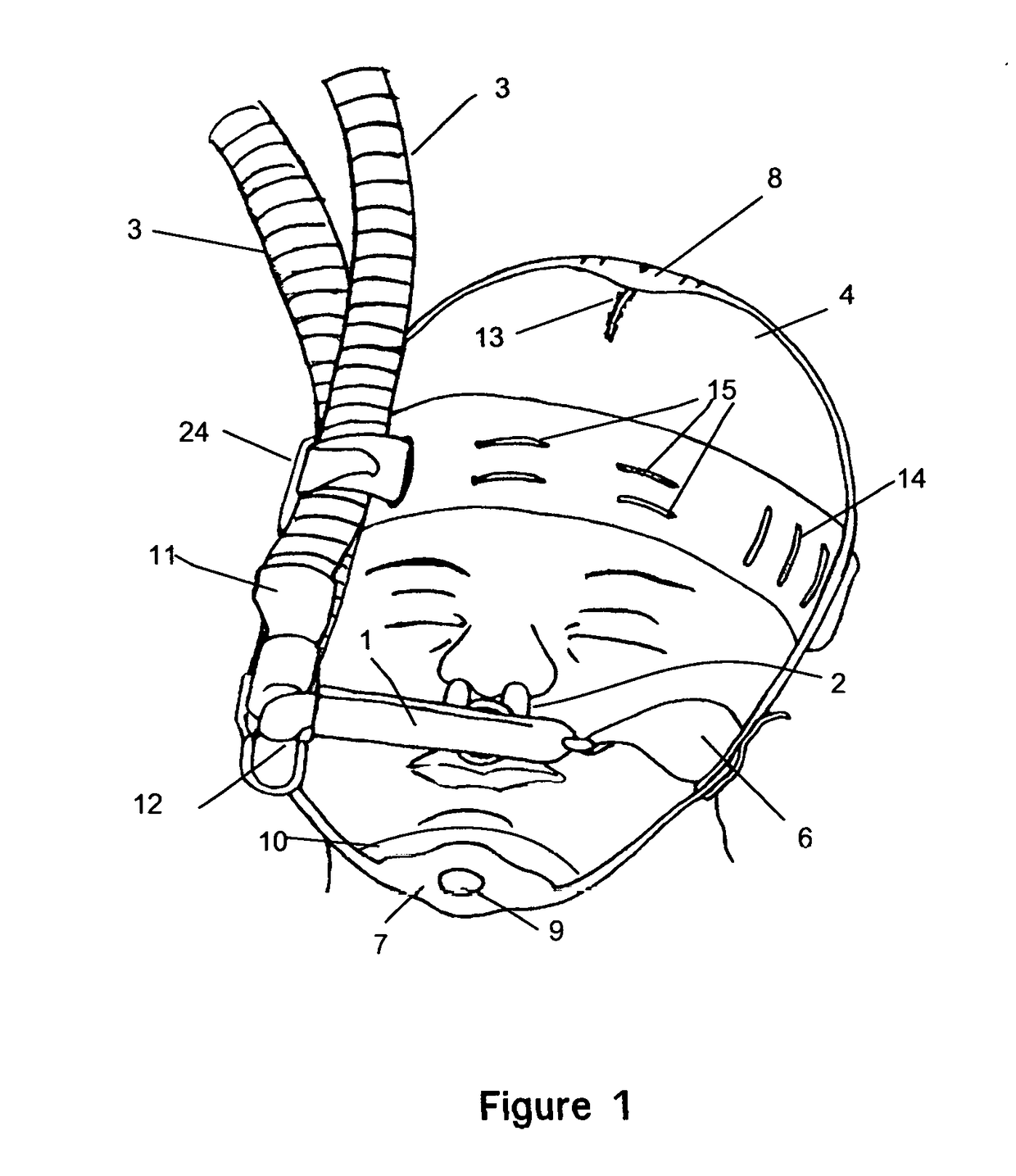 NICU CPAP Cannula 360 Circuitry Support System