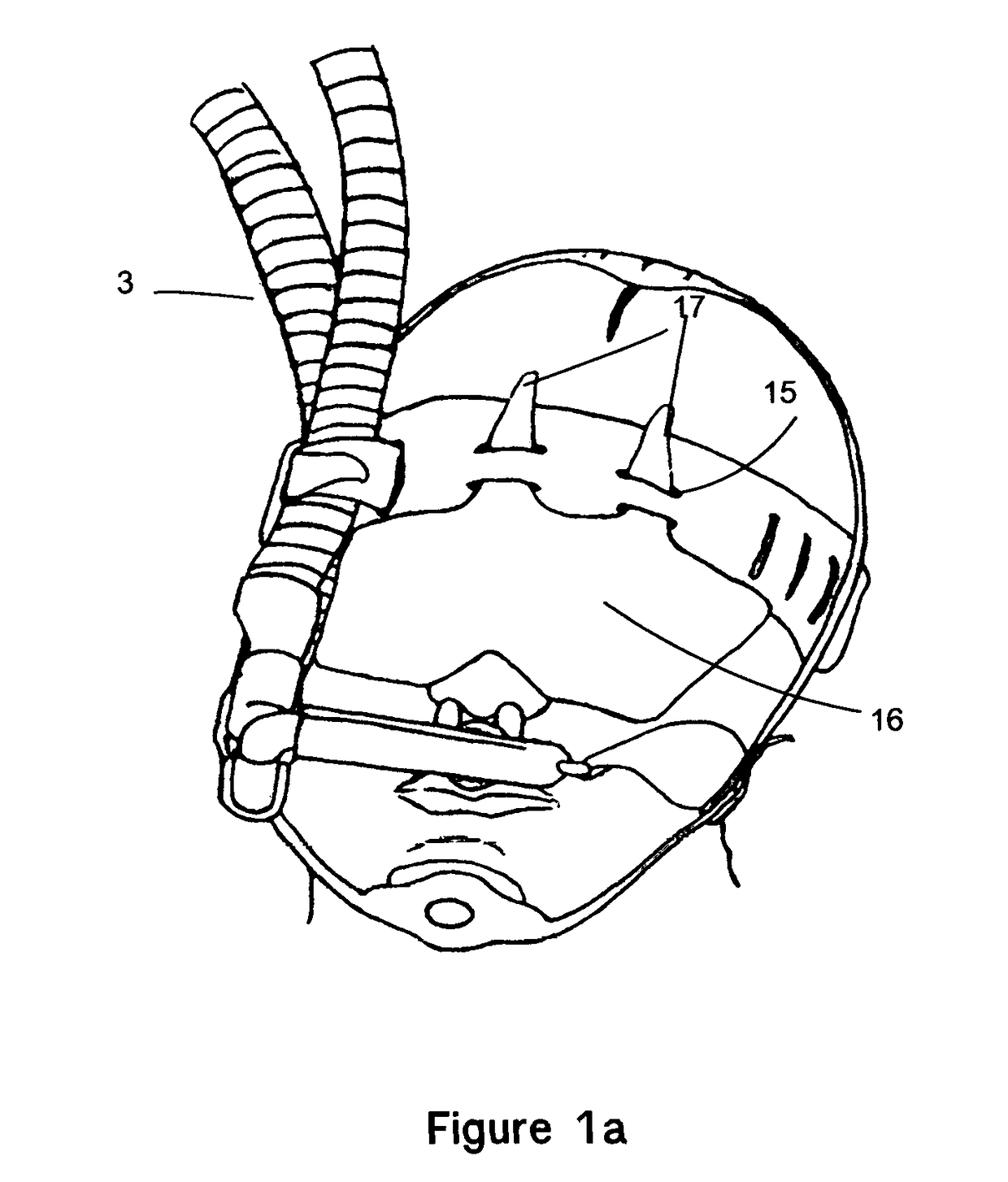 NICU CPAP Cannula 360 Circuitry Support System