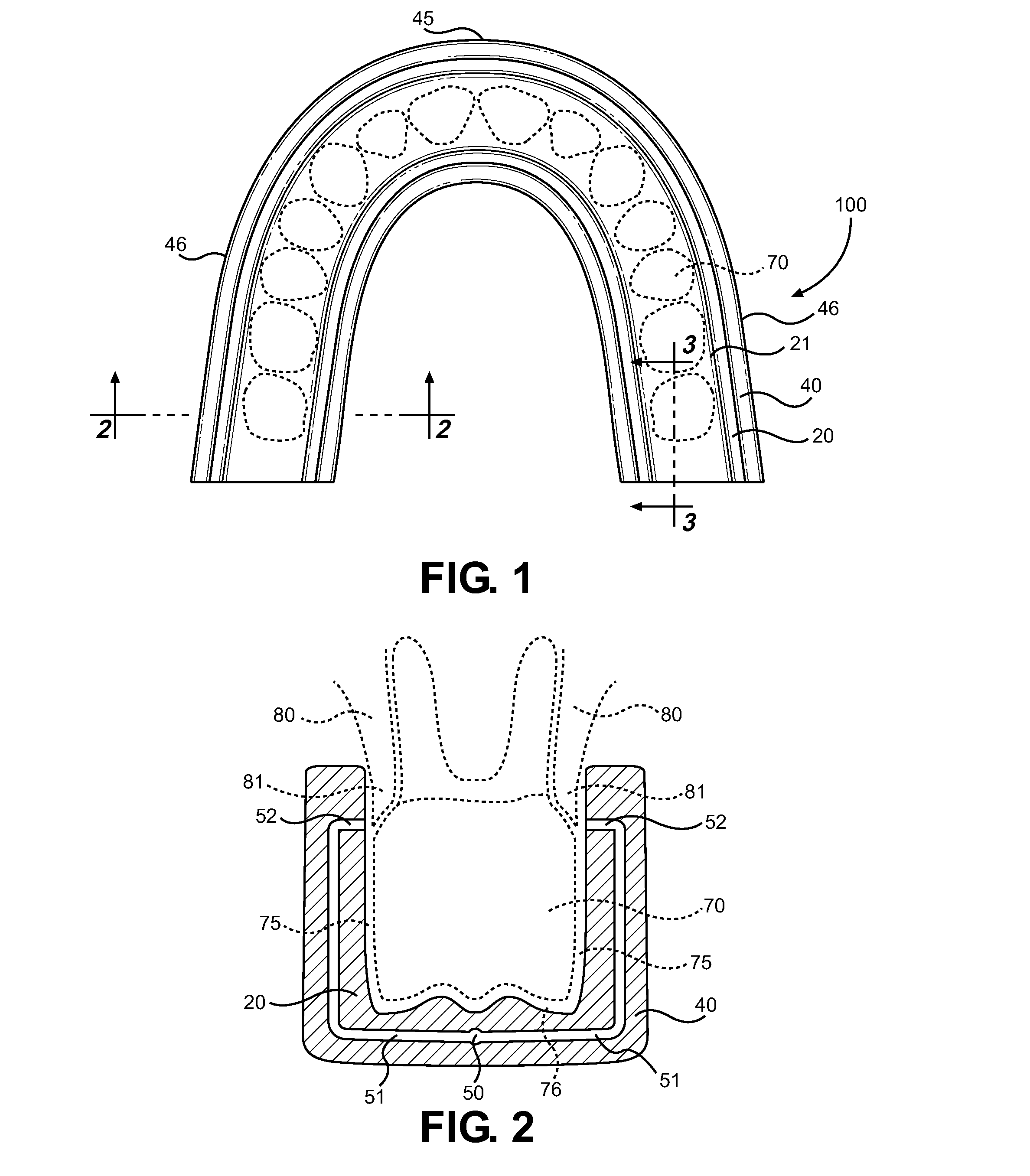 Oral Hygiene Appliance