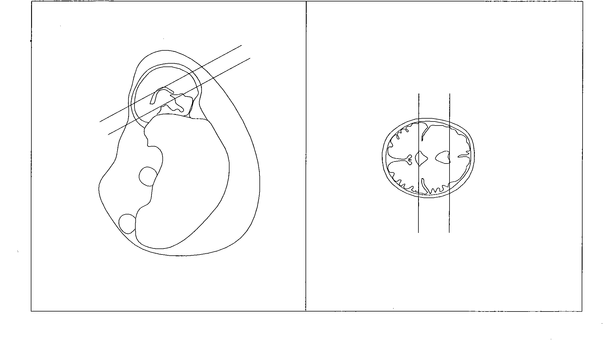 Method for positioning three axial positions of fetal brain through nuclear magnetic resonance