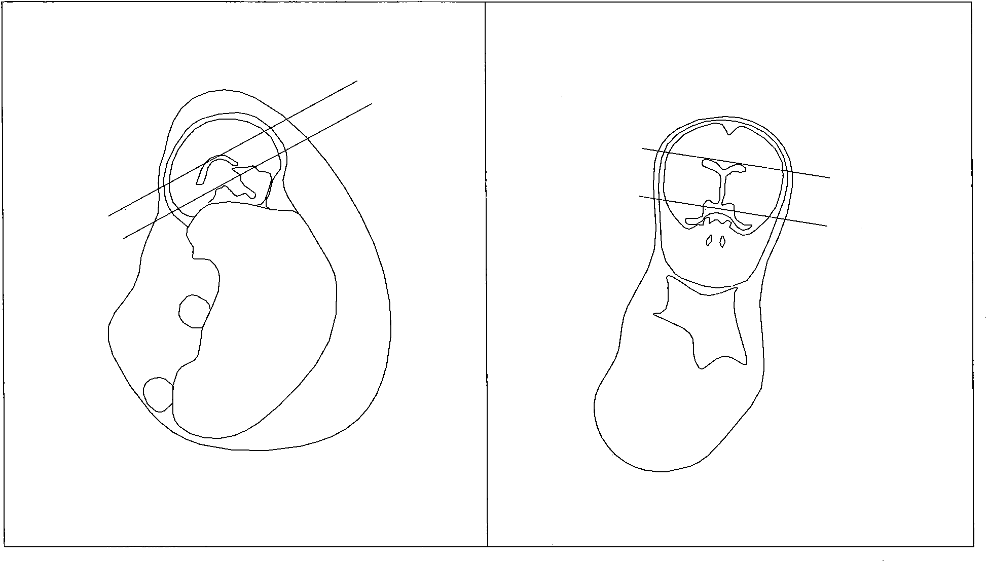 Method for positioning three axial positions of fetal brain through nuclear magnetic resonance