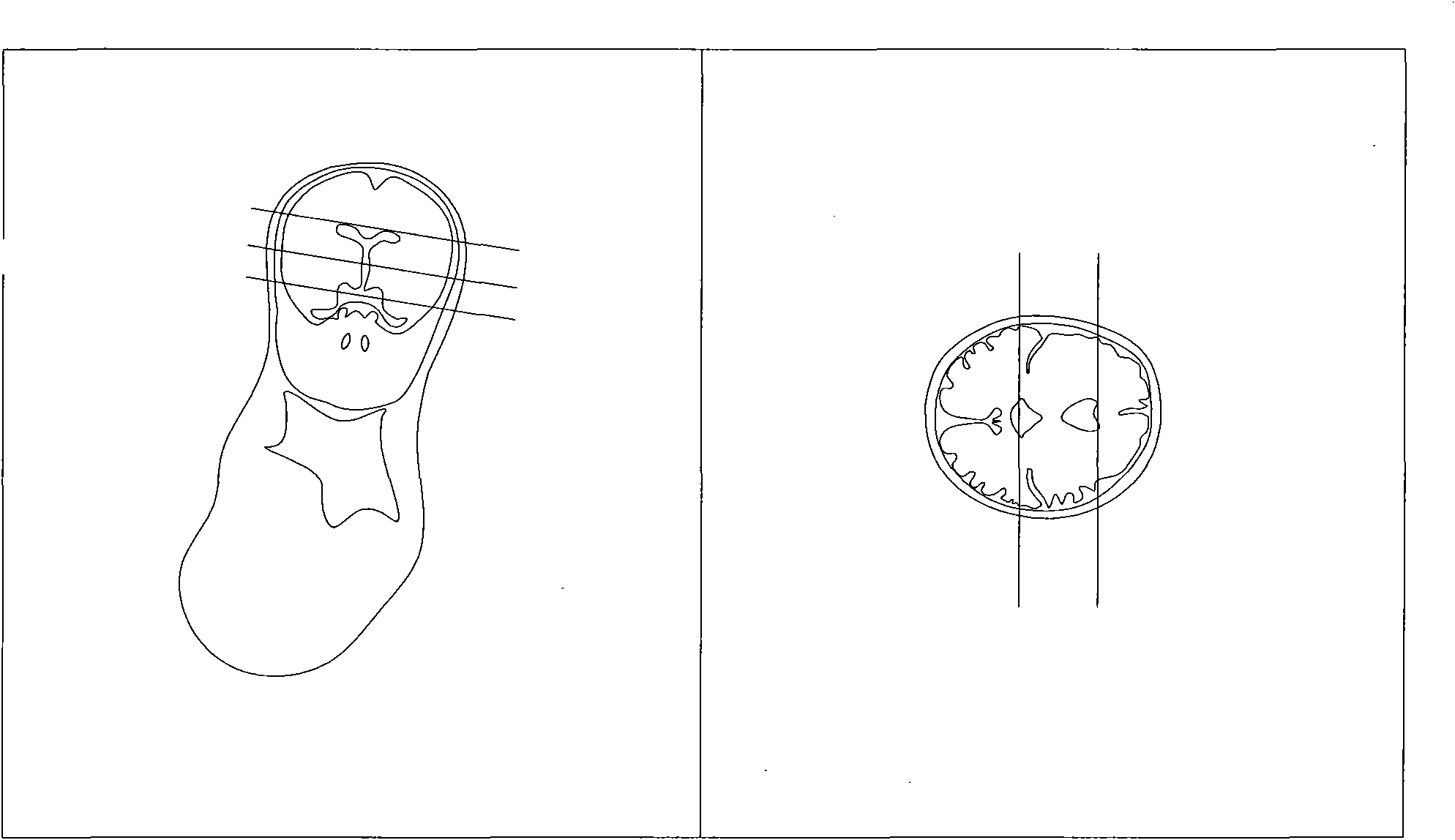 Method for positioning three axial positions of fetal brain through nuclear magnetic resonance