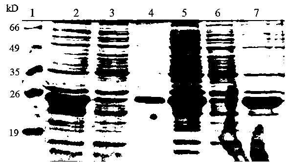 Human fibroblast growth factor 21 recombinant protein and its preparation method and application