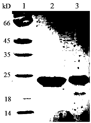 Human fibroblast growth factor 21 recombinant protein and its preparation method and application