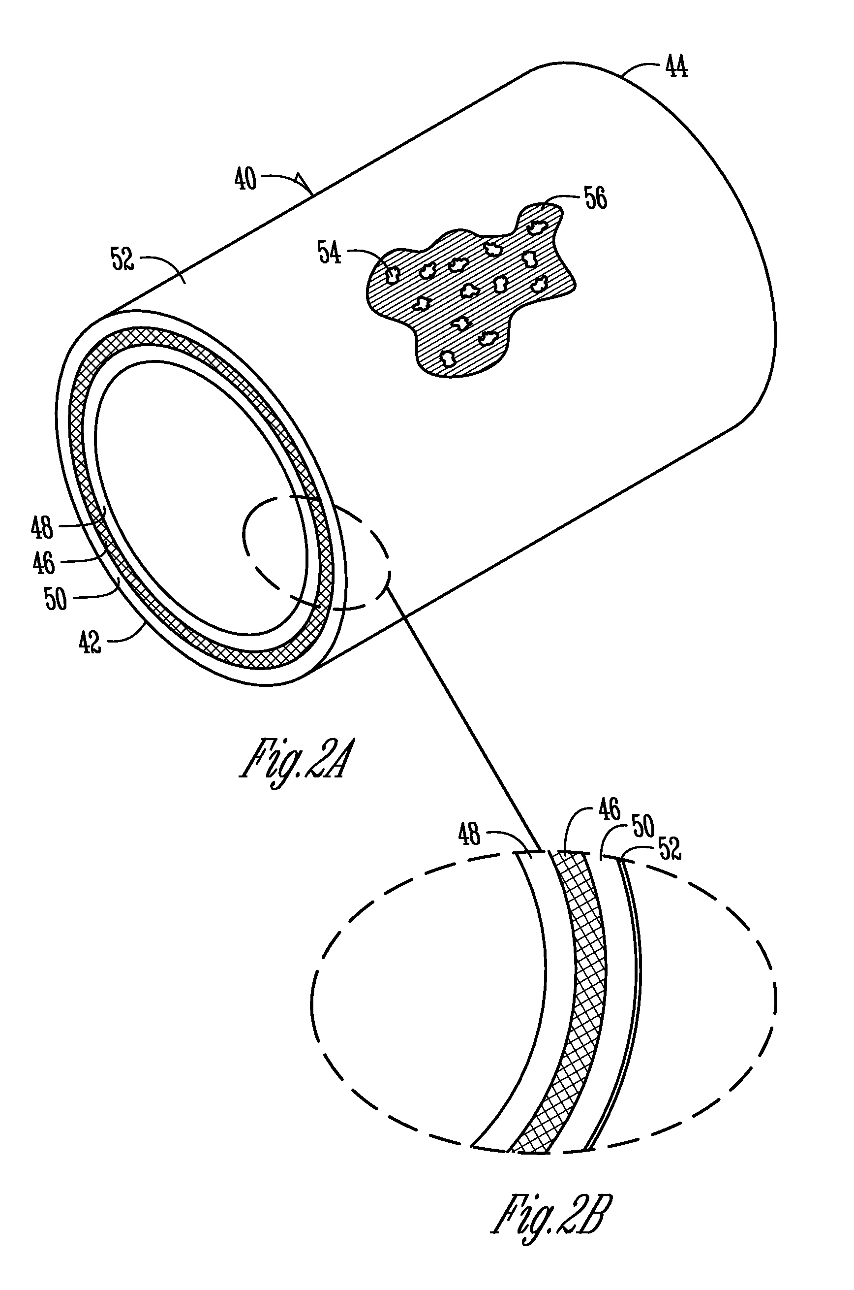 Liner tube with non-stretching material