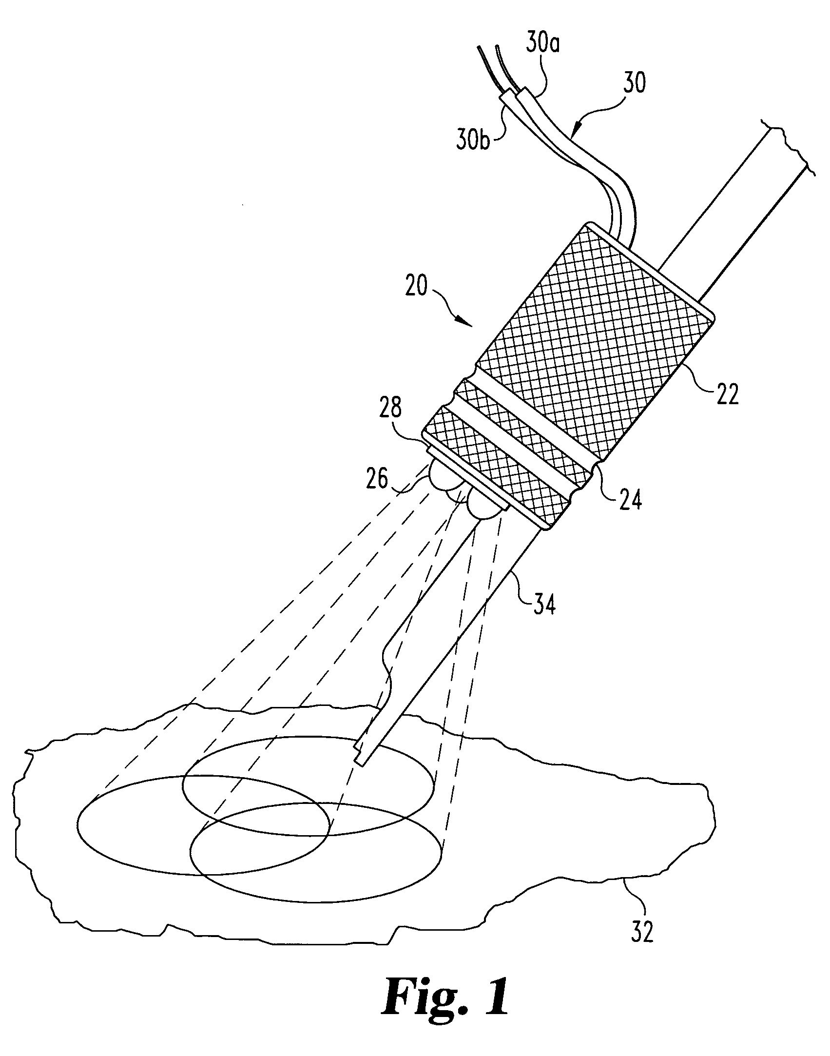 Lighted grip and alligator clip cord for tattoo machine