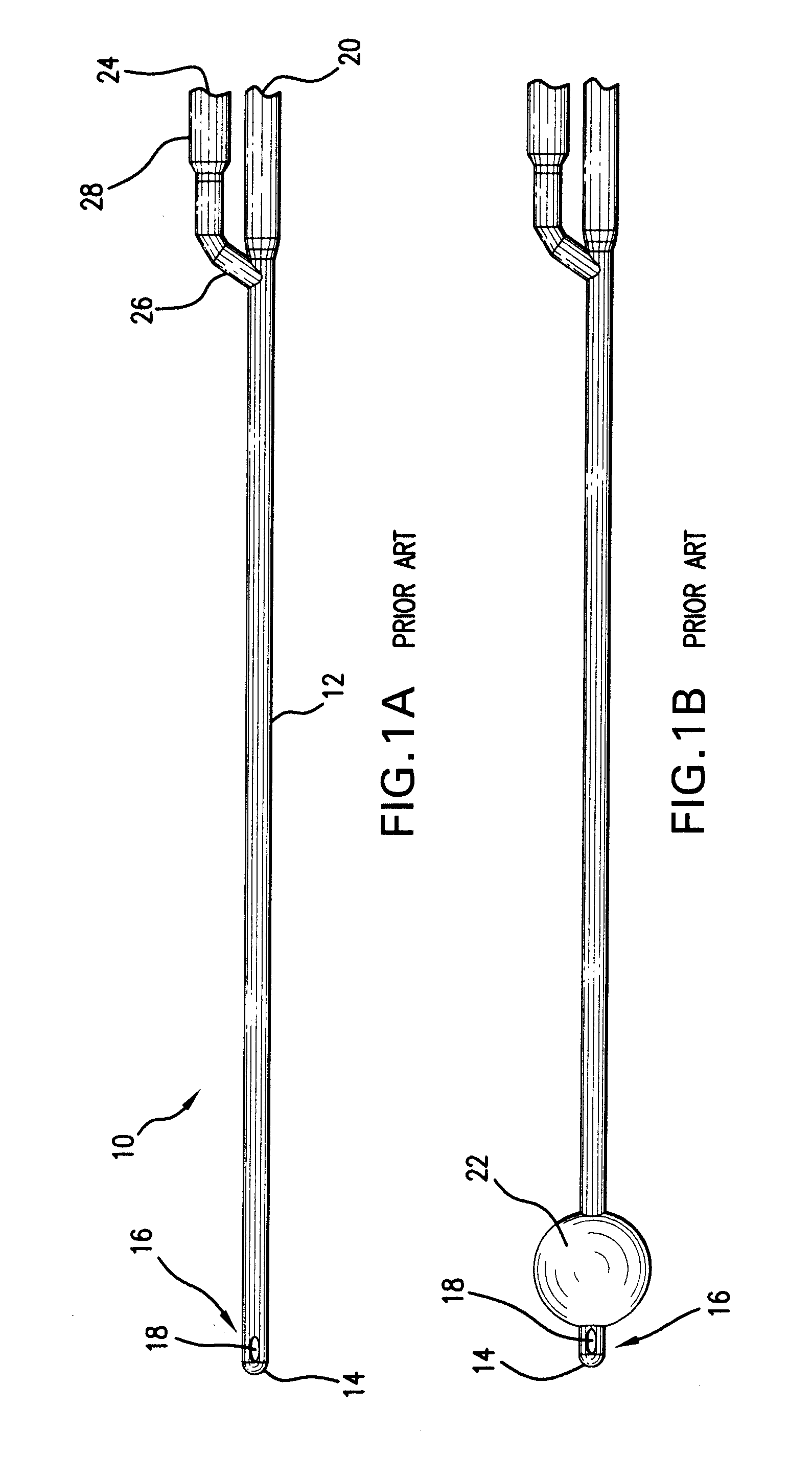 Indwelling urinary catheter with self-retaining mechanism