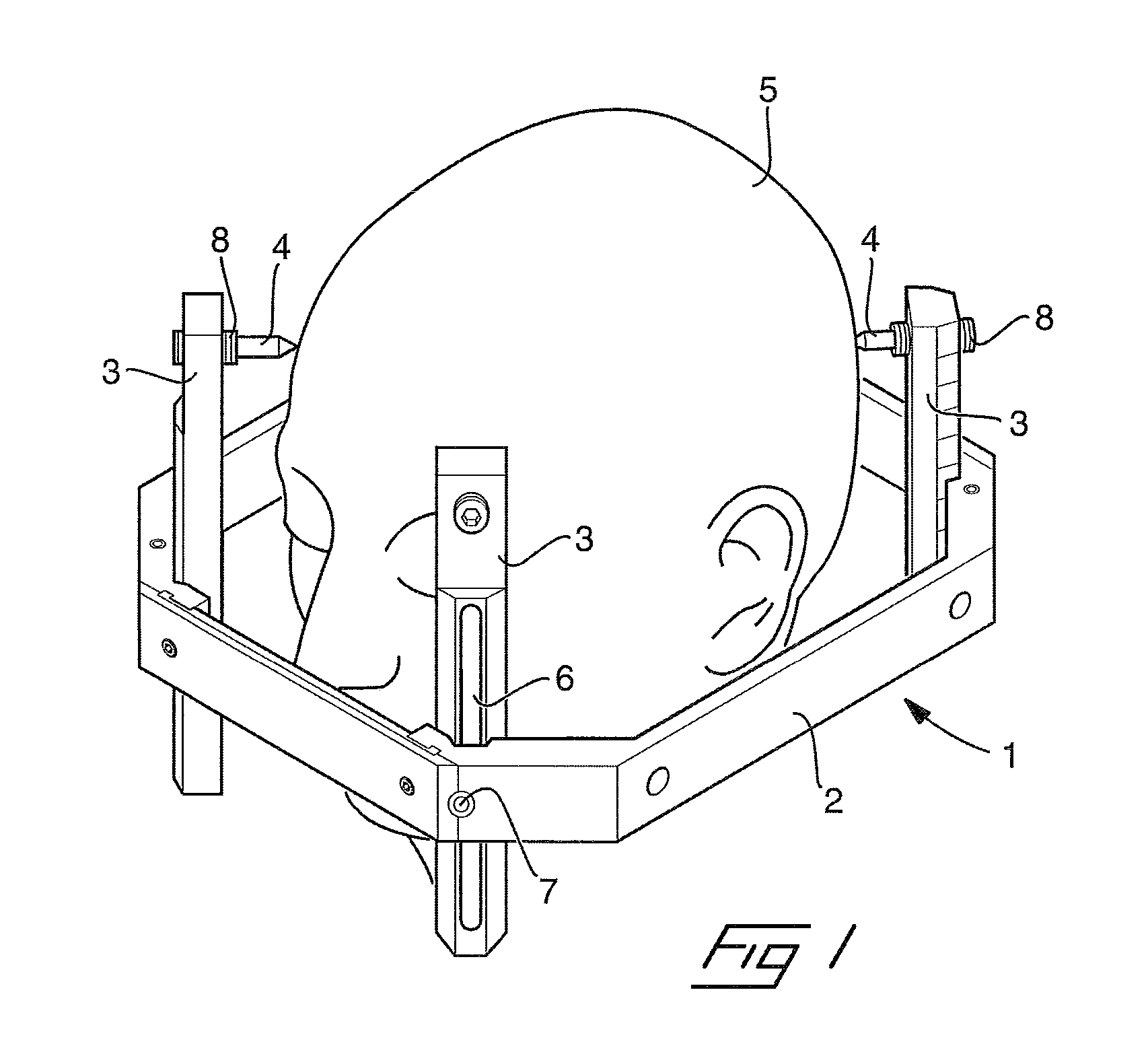 Rigid skull fixation