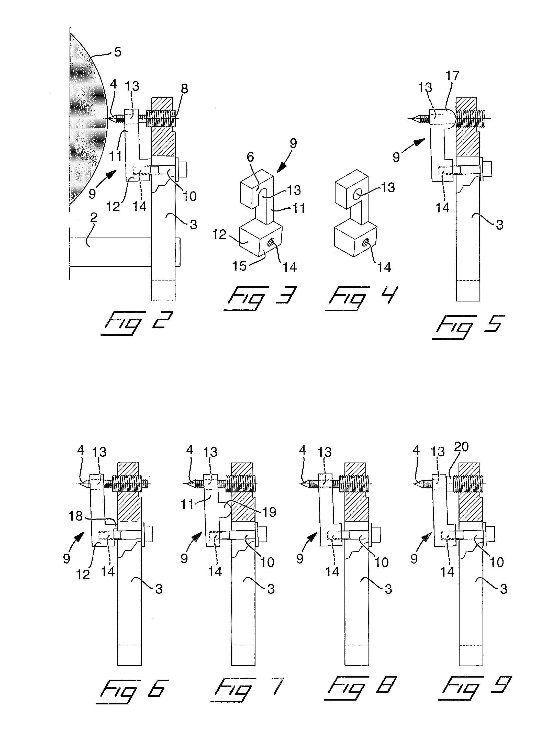 Rigid skull fixation