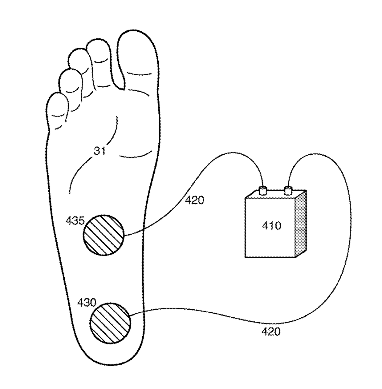 Programmable electrical stimulation of the foot muscles