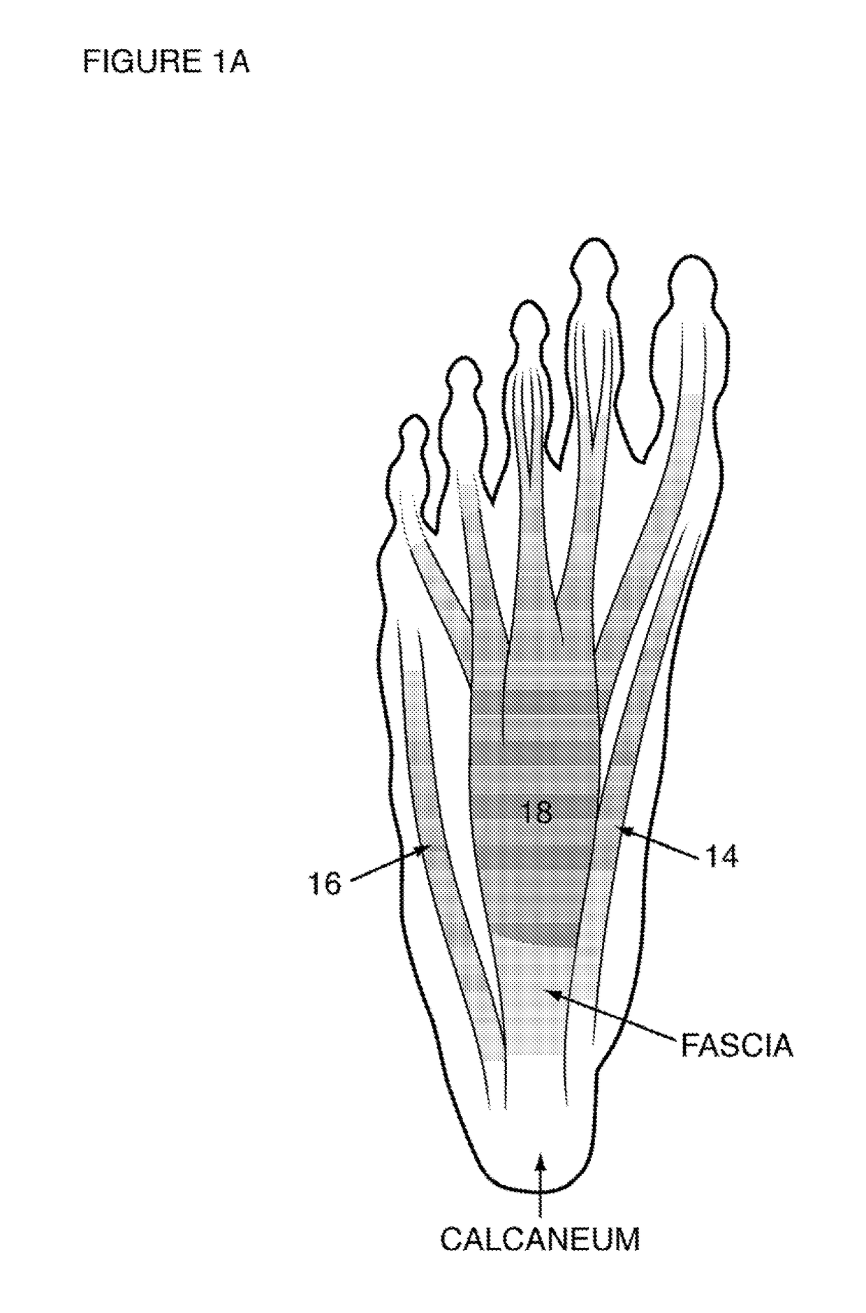 Programmable electrical stimulation of the foot muscles