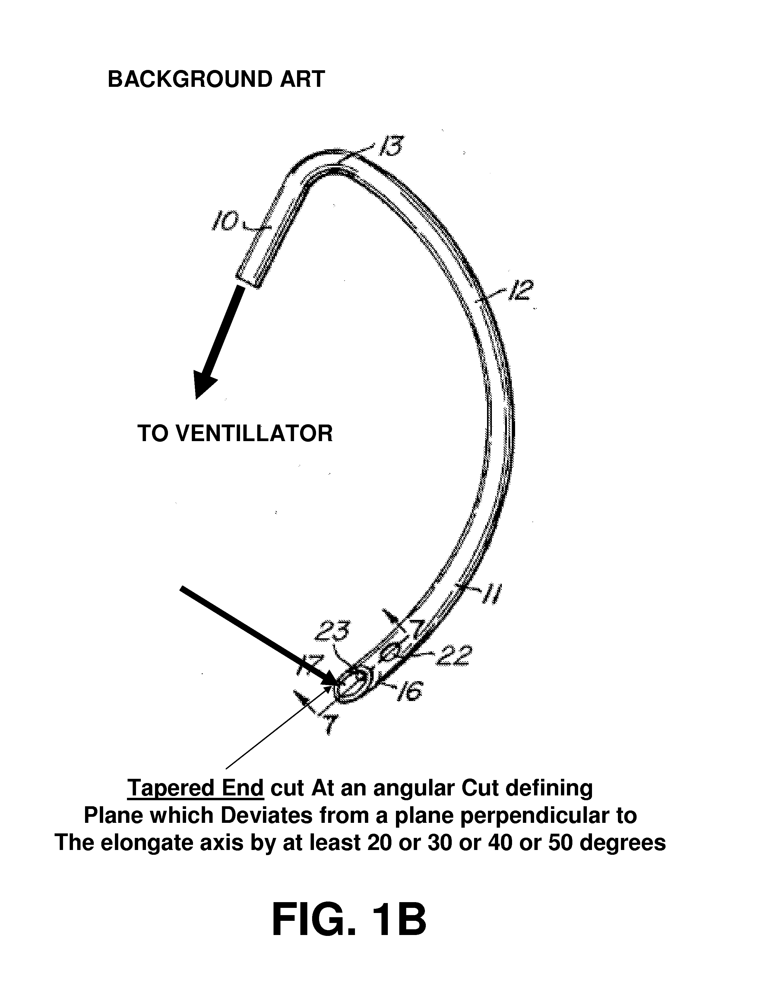 Method and apparatus for blocking fluid flow in an intubated trachea