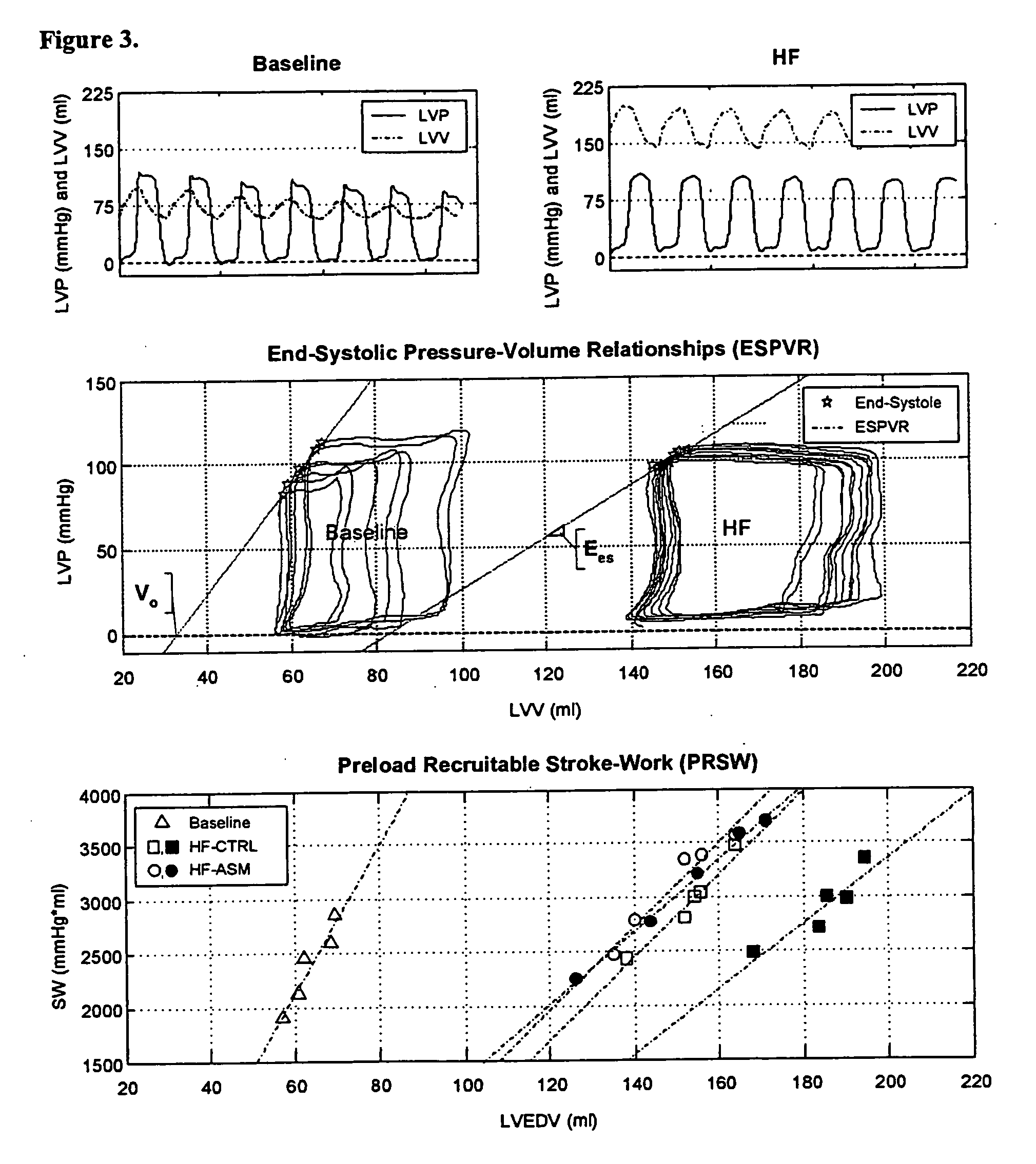 Treatment for heart disease