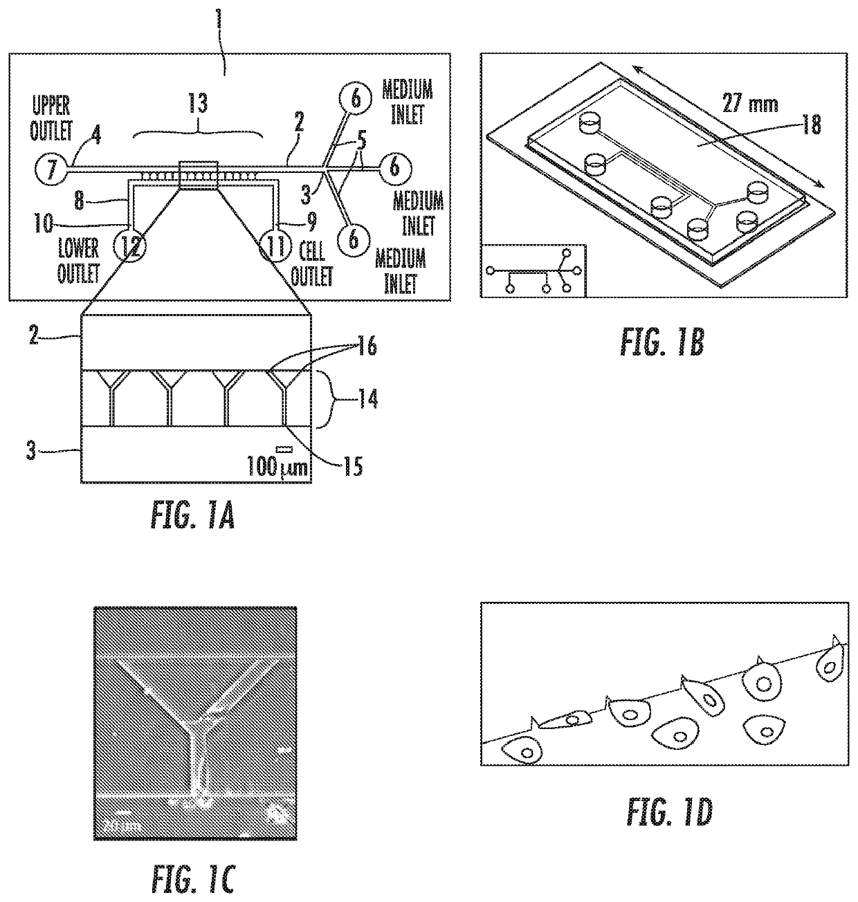 Use of an integrated microfluidic chip for analysis of cell motility and prediction and prognosis of patient survival