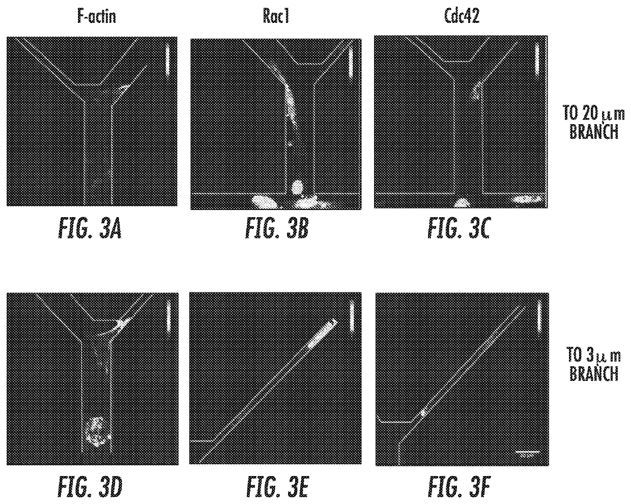 Use of an integrated microfluidic chip for analysis of cell motility and prediction and prognosis of patient survival