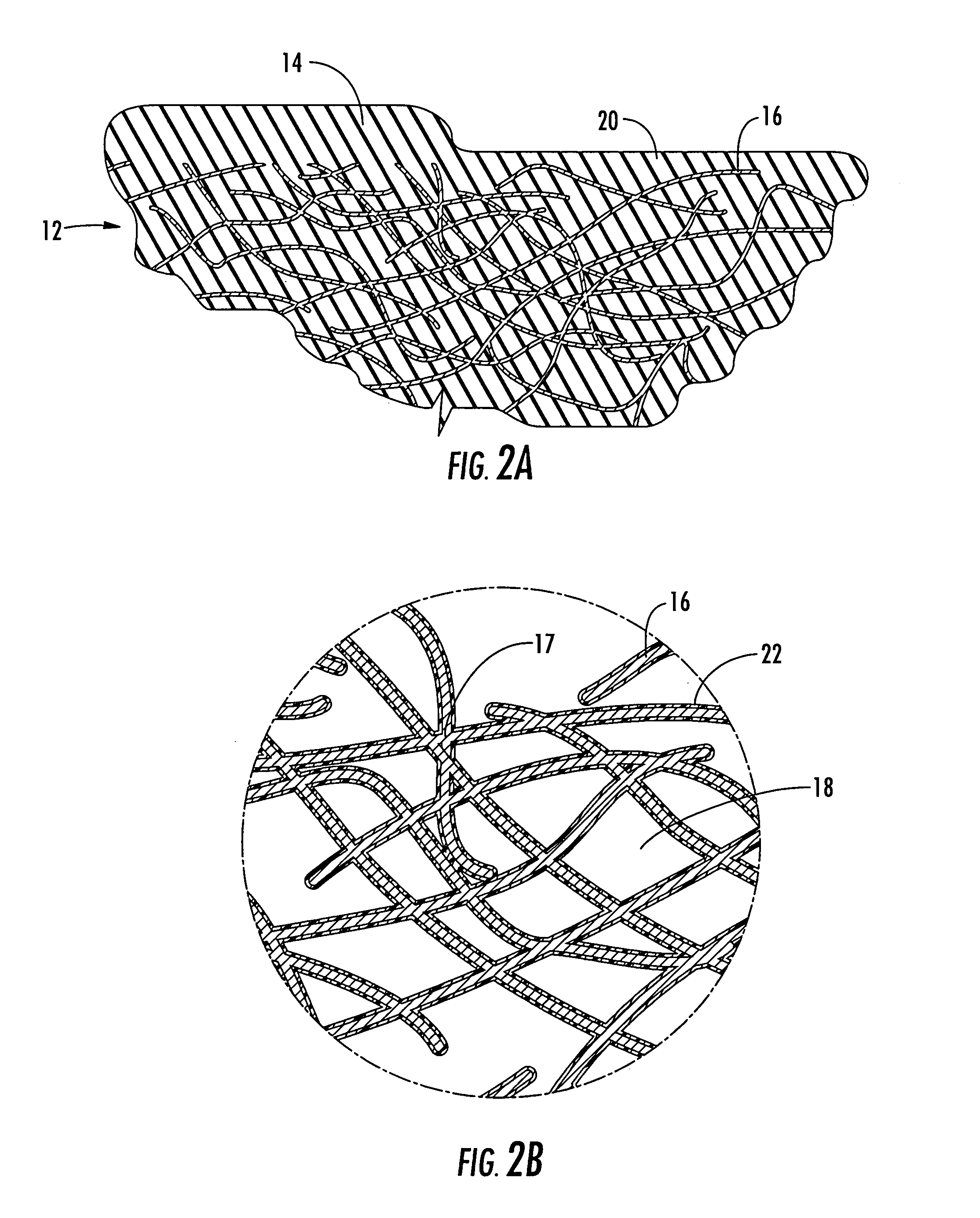 Reinforced elastic fiberous web