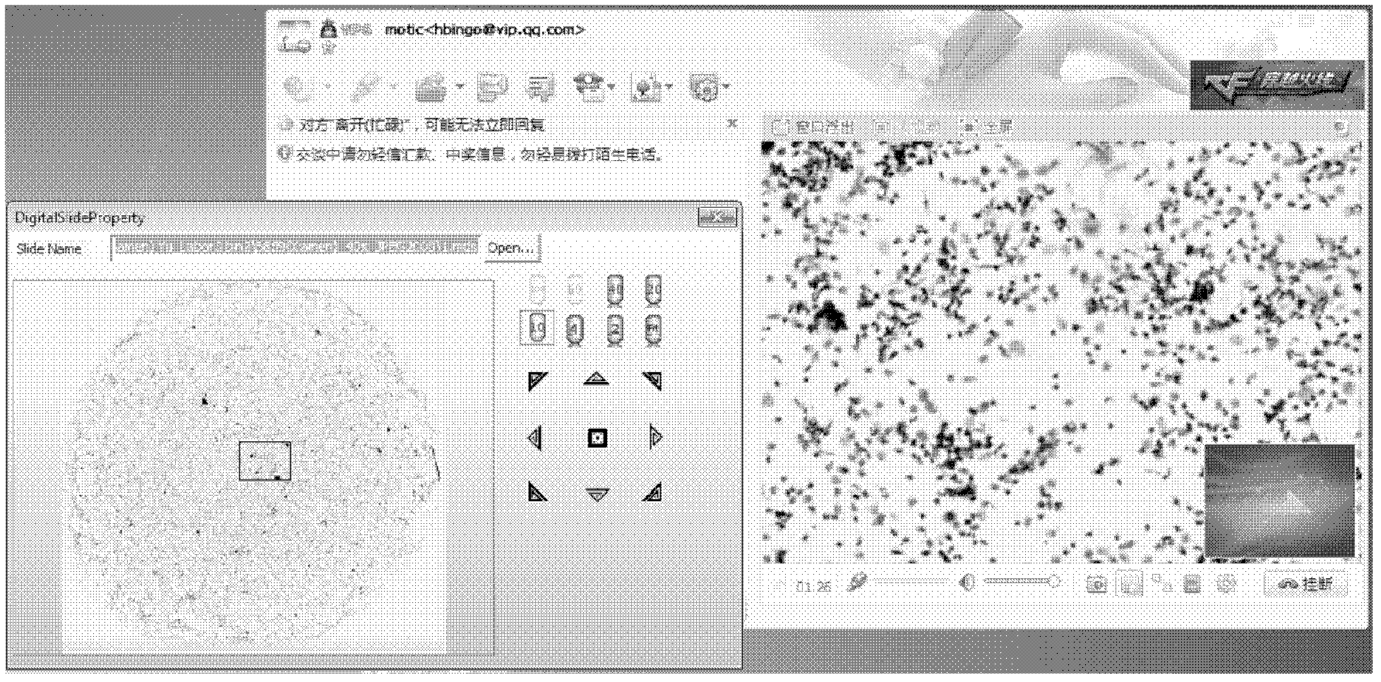 Remote browsing system and method for pathological digital slices