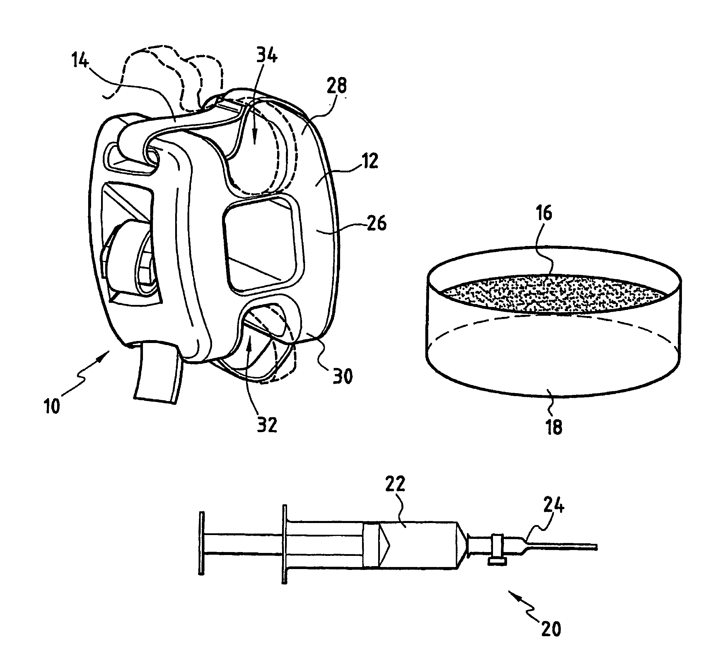 Unit for treatment of the degeneration of an intervertebral disc